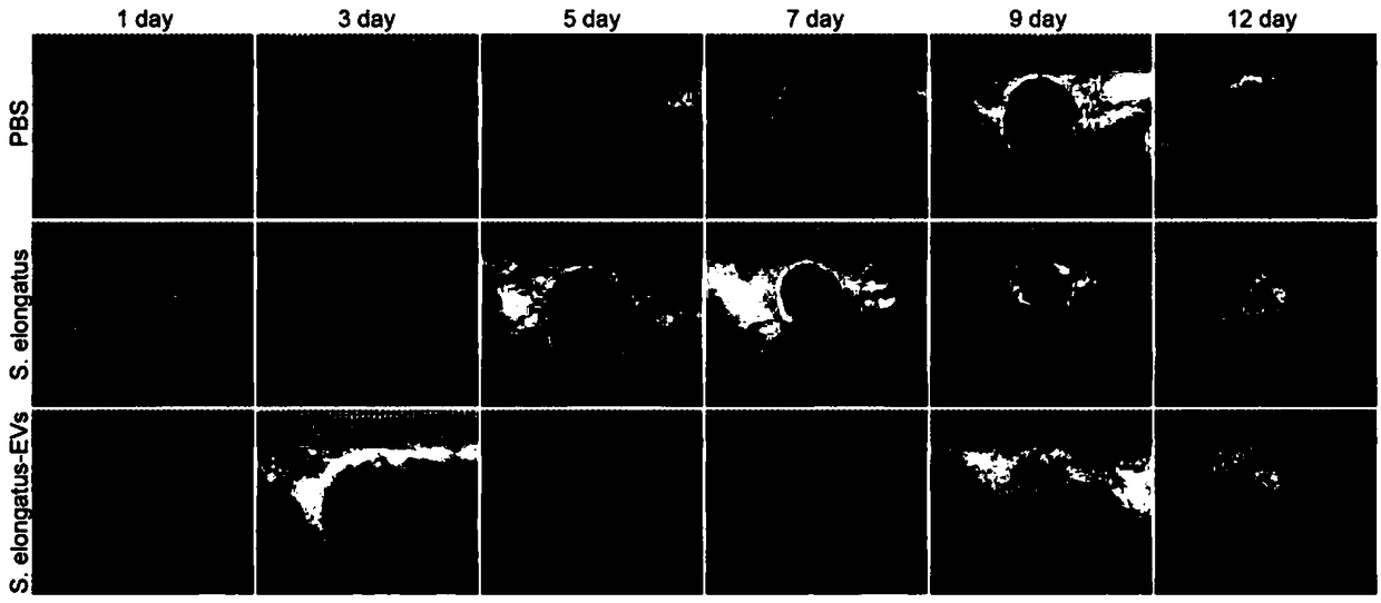 Application of cyanobacteria and extracellular vesicle thereof in preparation of medicines for treating diseases