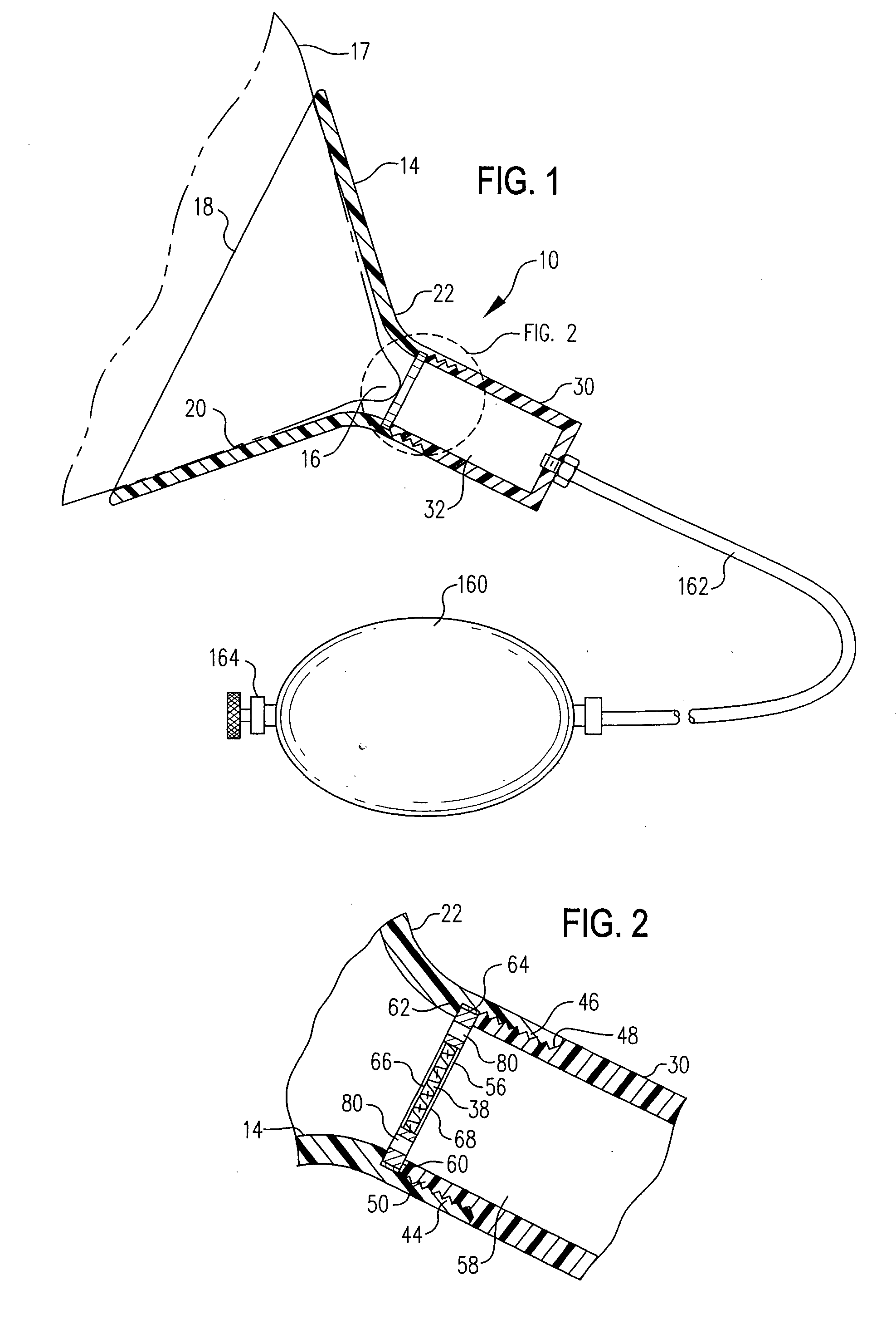 Devices and methods for obtaining mammary fluid samples for evaluating breast diseases, including cancer