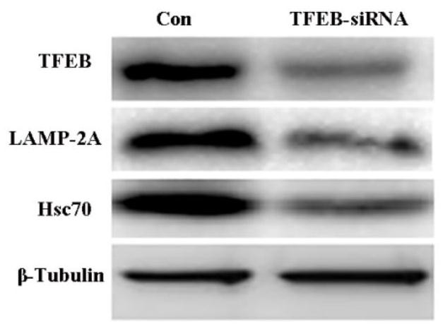 A short peptide that promotes nuclear translocation of tfeb and a linear short peptide based on it and its application in alleviating cerebral ischemic injury