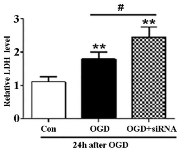 A short peptide that promotes nuclear translocation of tfeb and a linear short peptide based on it and its application in alleviating cerebral ischemic injury