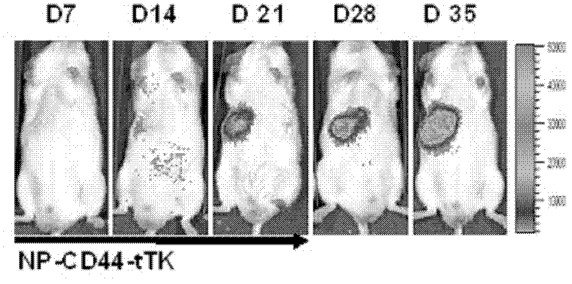 Liposome medicinal composition with tumor targeting, in-vivo tracing and treating functions and preparation method thereof