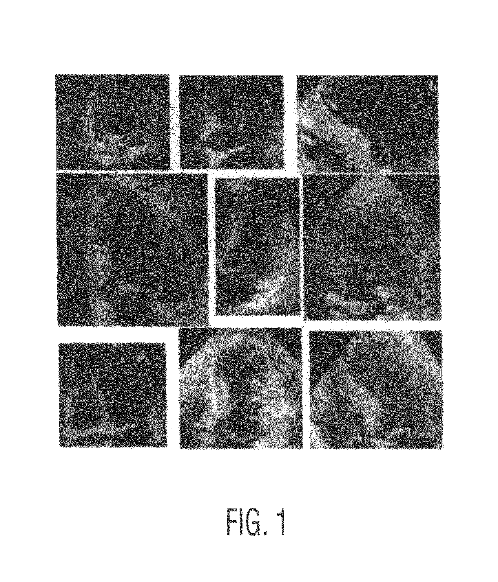 Method of database-guided segmentation of anatomical structures having complex appearances