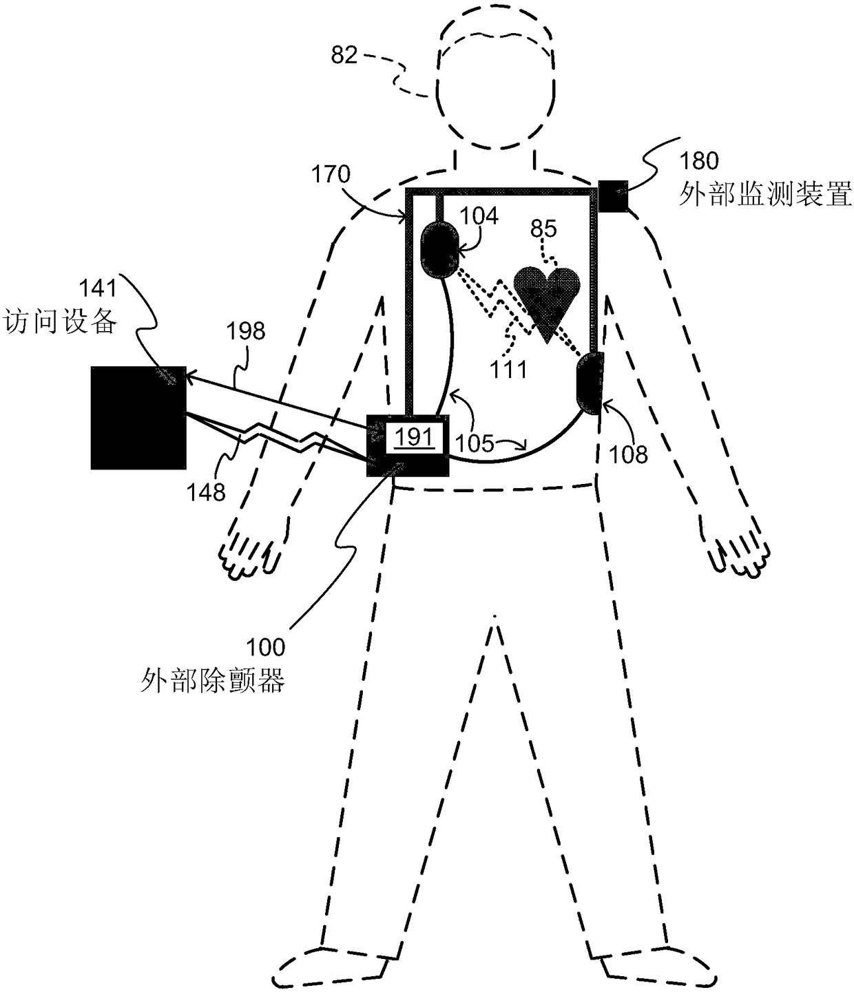 Wearable cardioverter defibrillator (WCD) system uploading configuration data via safety label