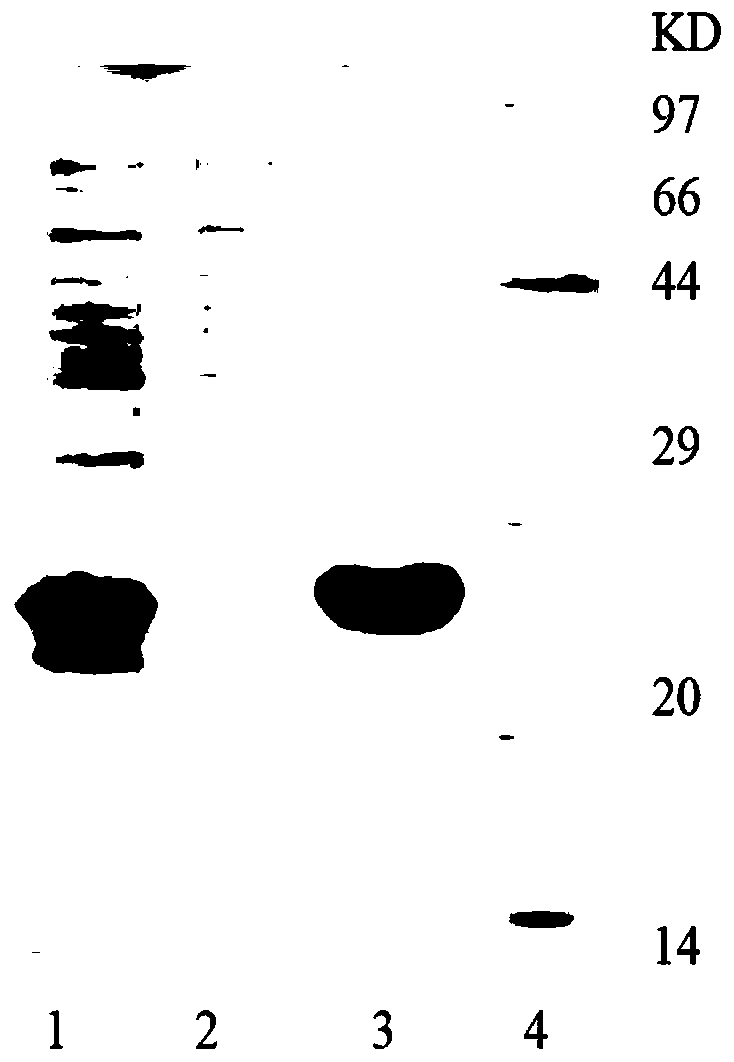 Recombinant human Coxsackie virus group-B proteins and application thereof