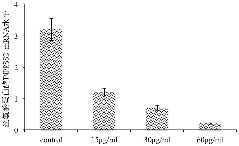 Application of Yiqing compound preparation to preparation of drugs for preventing/treating novel coronavirus infection