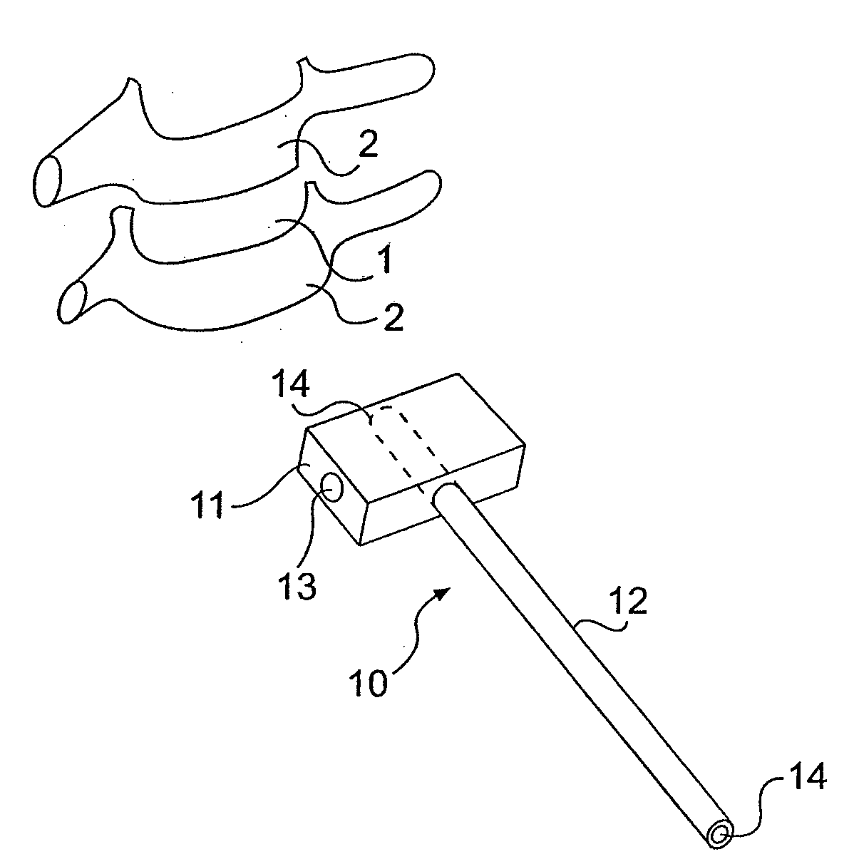 Instrument set for fitting an intervertebral jont prosthesis