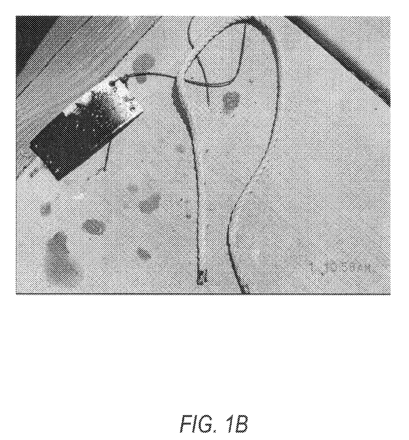 Polymer coatings containing phytochemical agents and methods for making and using same