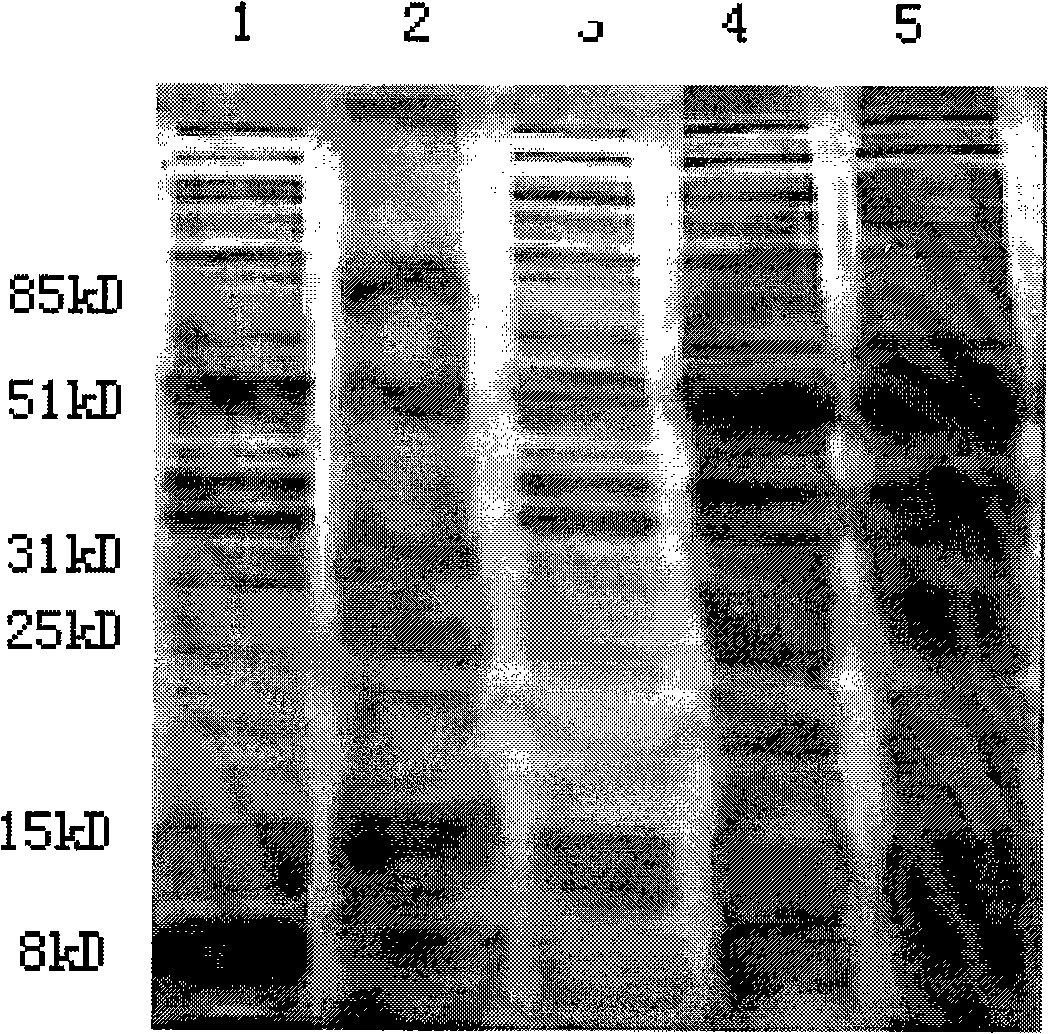 Production method for streptococcus specific bacteriophage lyase