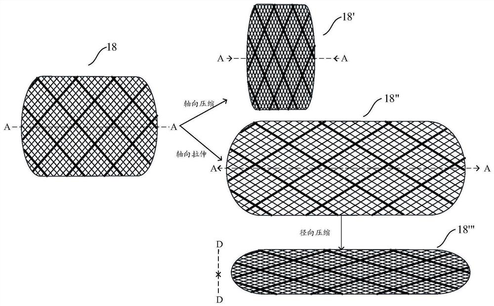 Bare stent compressible and stretchable in axial direction