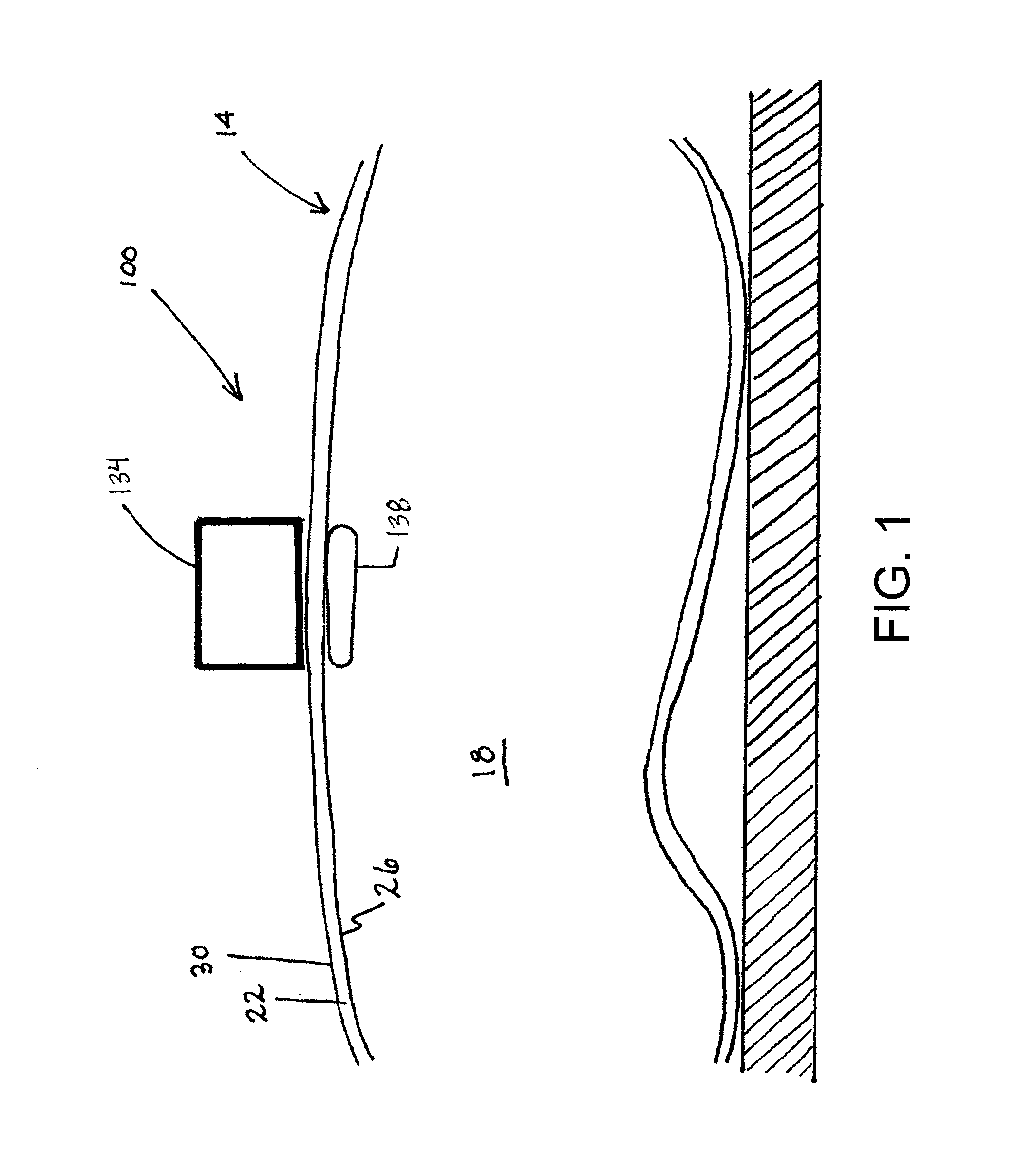 Medical Devices That Include Removable Magnet Units and Related Methods