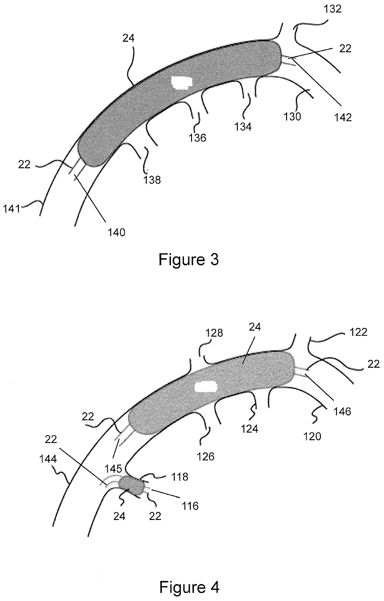 Devices and Methods for Vascular Hyperperfusion of Extravascular Space
