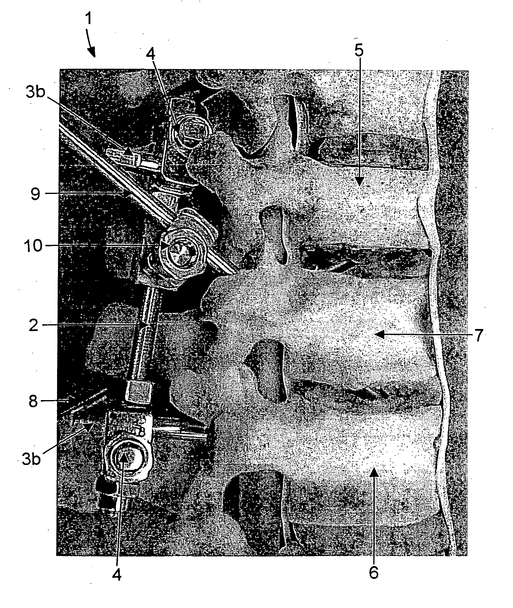 Spinal fixation support device and methods of using