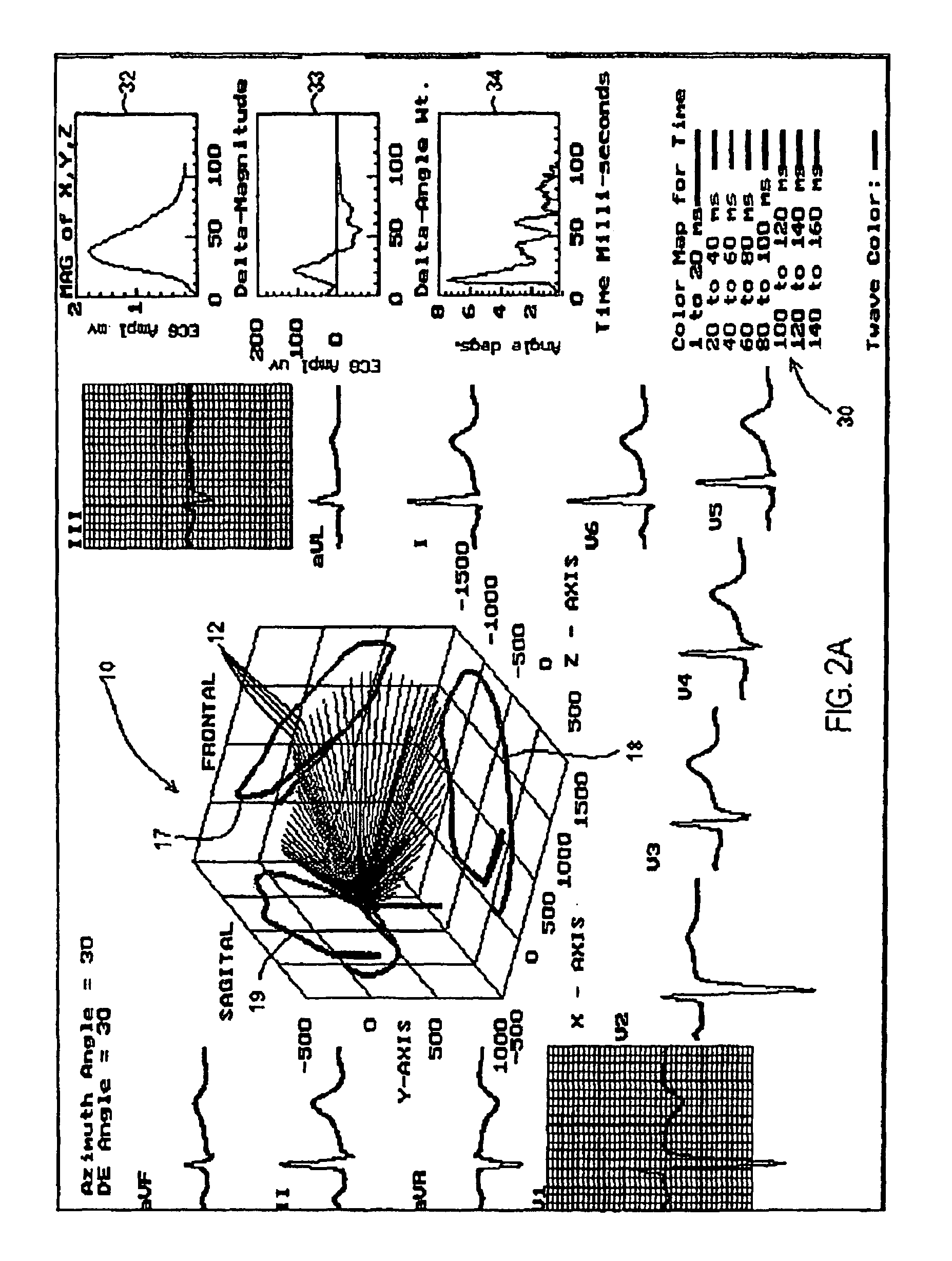 Three dimensional vector cardiograph and method for detecting and monitoring ischemic events