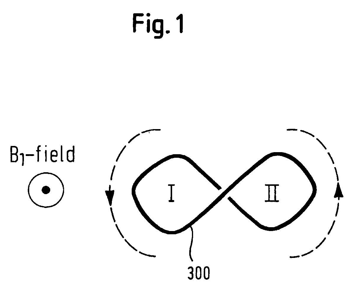 Mri Compatible Implant Comprising Electrically Conductively Closed Loops