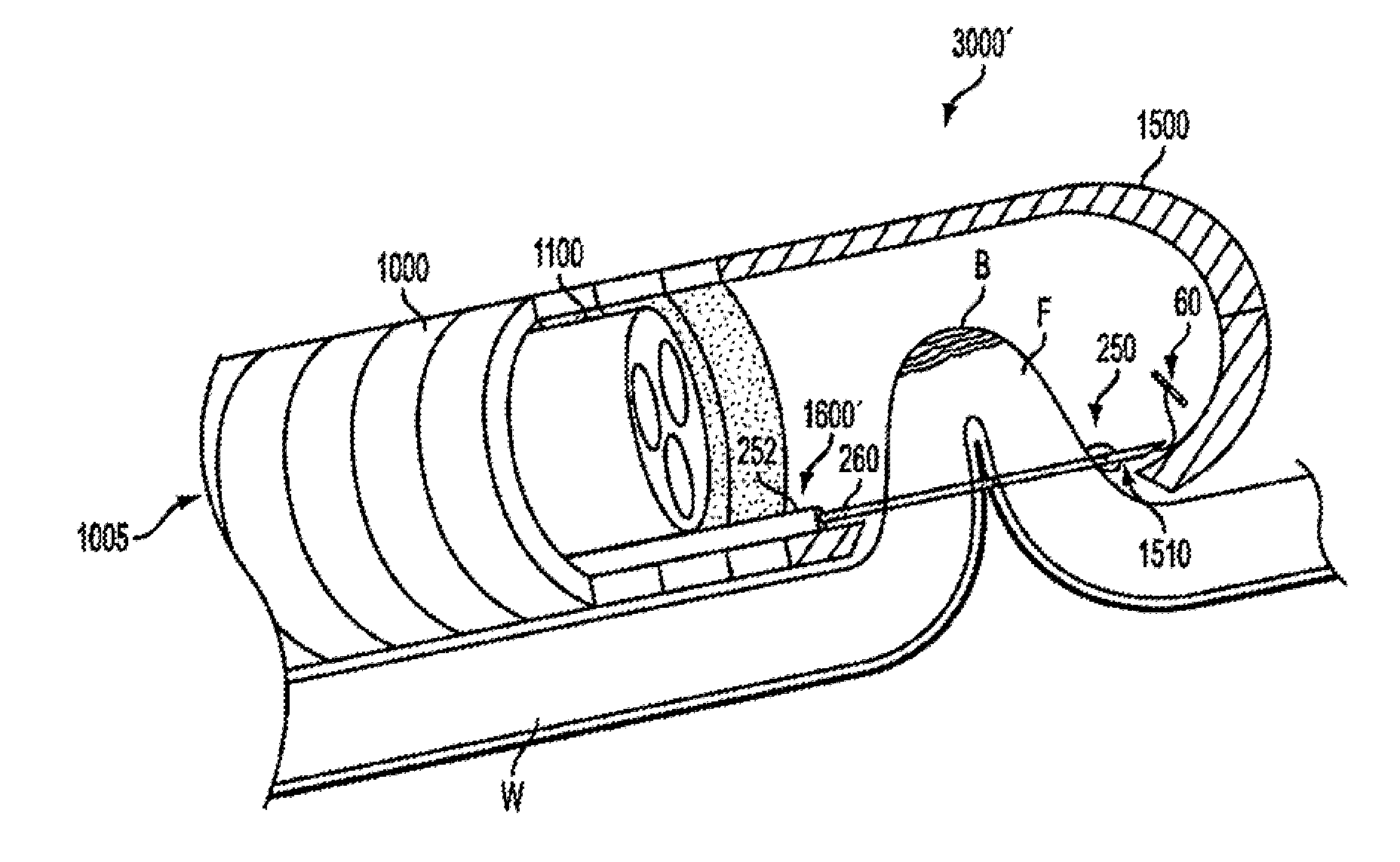 Apparatus and methods for forming and securing gastrointestinal tissue folds