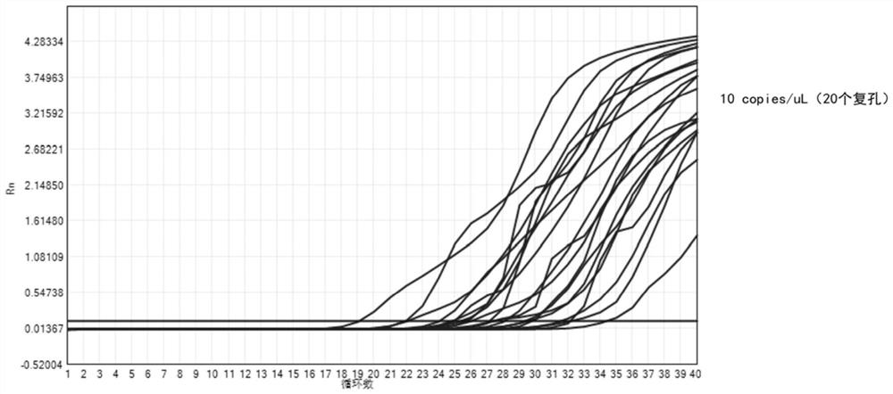 Kit for rapidly detecting hantavirus SEOV-S4 subtype and detection method thereof