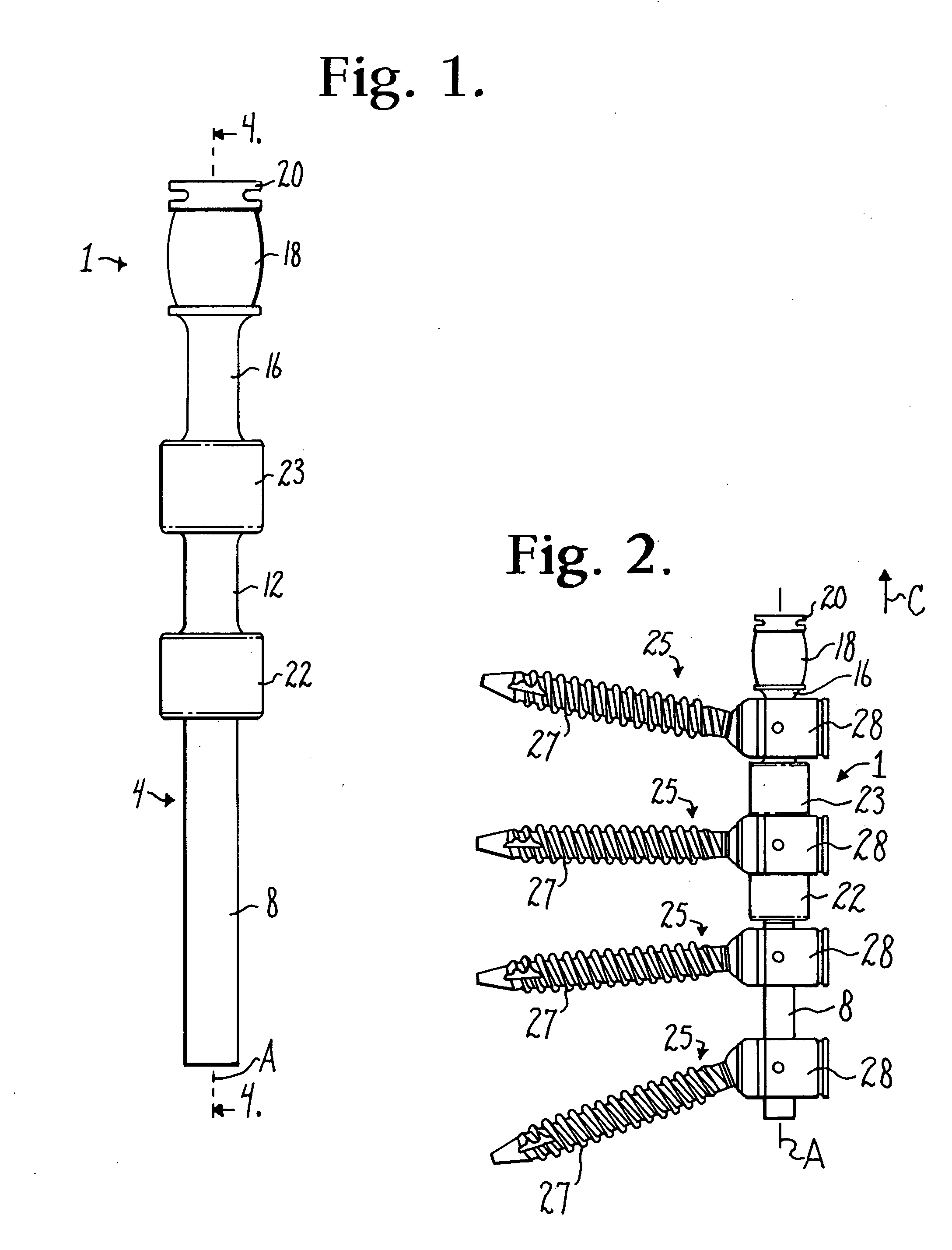 Dynamic stabilization assembly having pre-compressed spacers with differential displacements