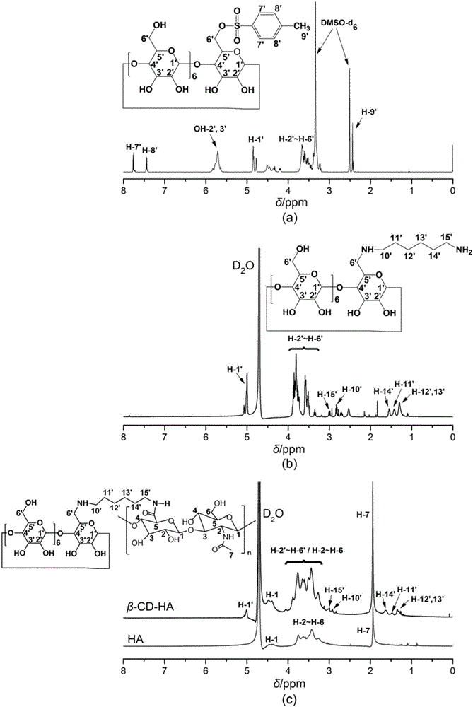 Drug sustained release type composite eye drops and preparation method and application thereof