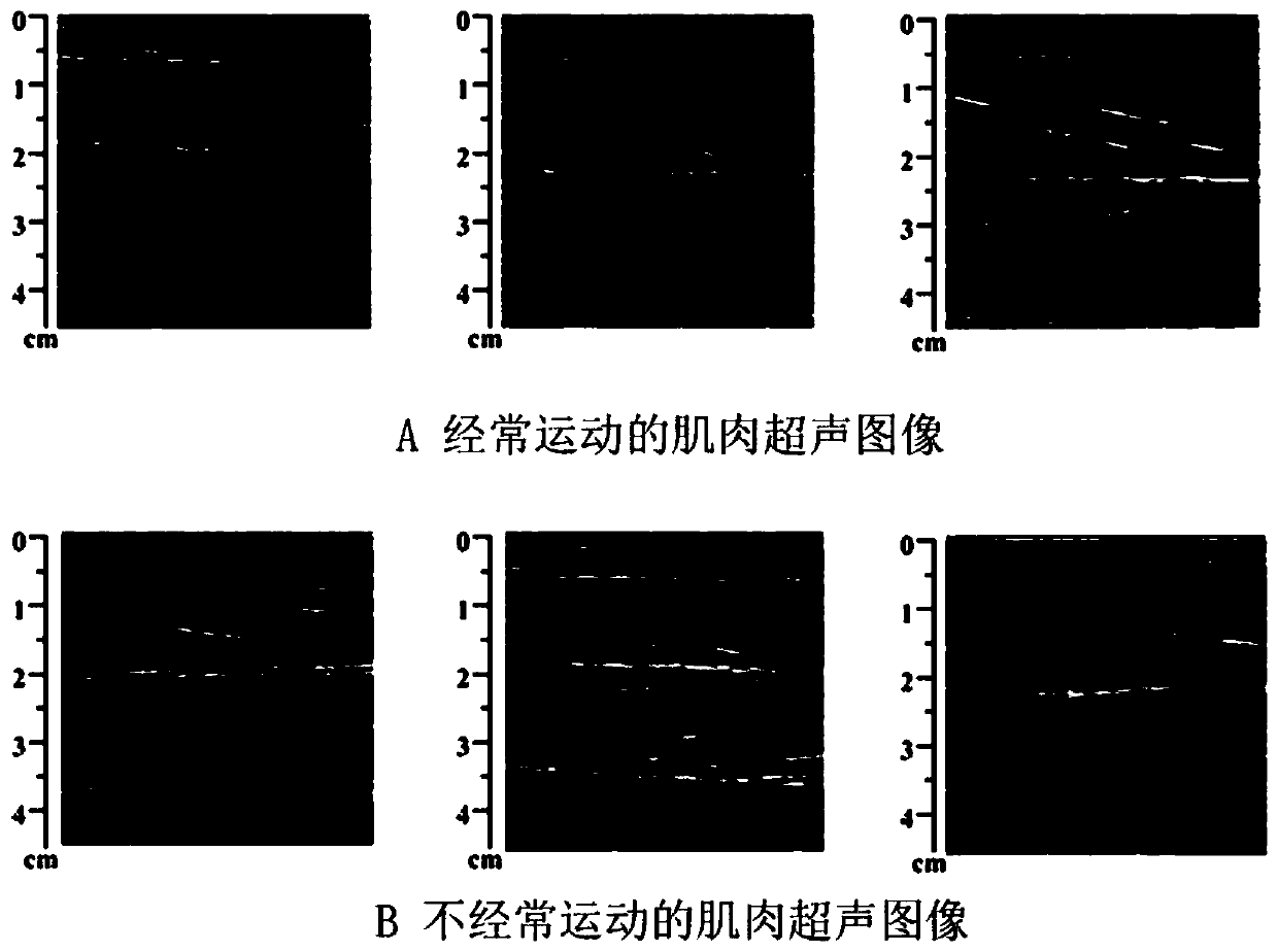 Muscle state quantitative evaluation method and device, storage medium and intelligent terminal