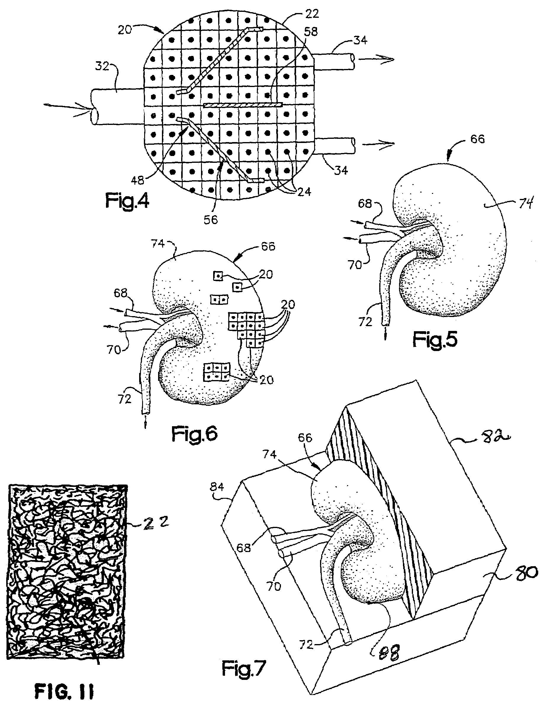 Scaffold and method for implanting cells