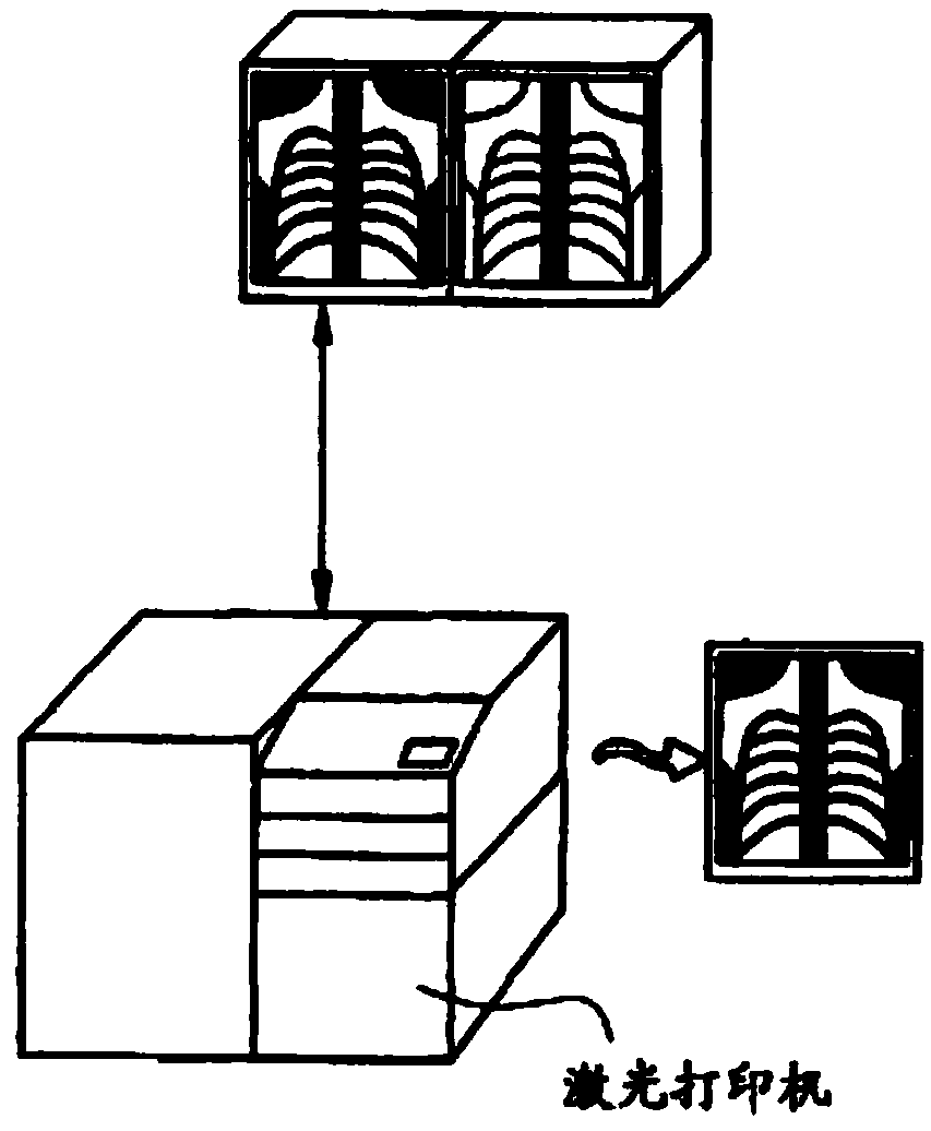 Extending type skeleton fibrograph