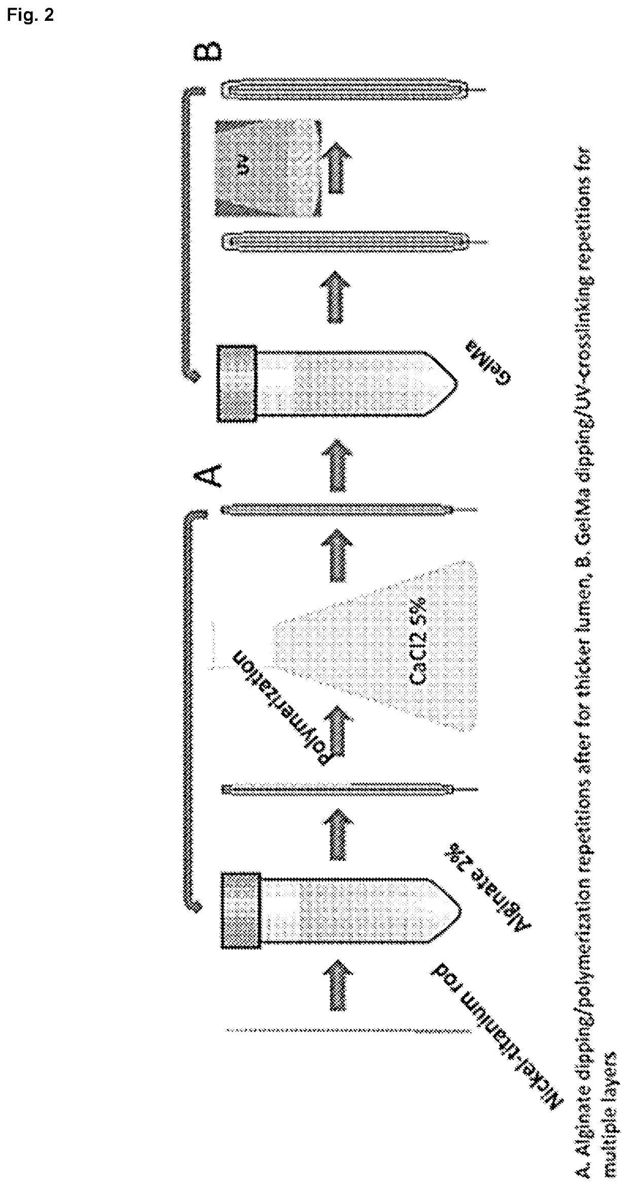 Automated fabrication of layer-by-layer tissue engineered complex tubes