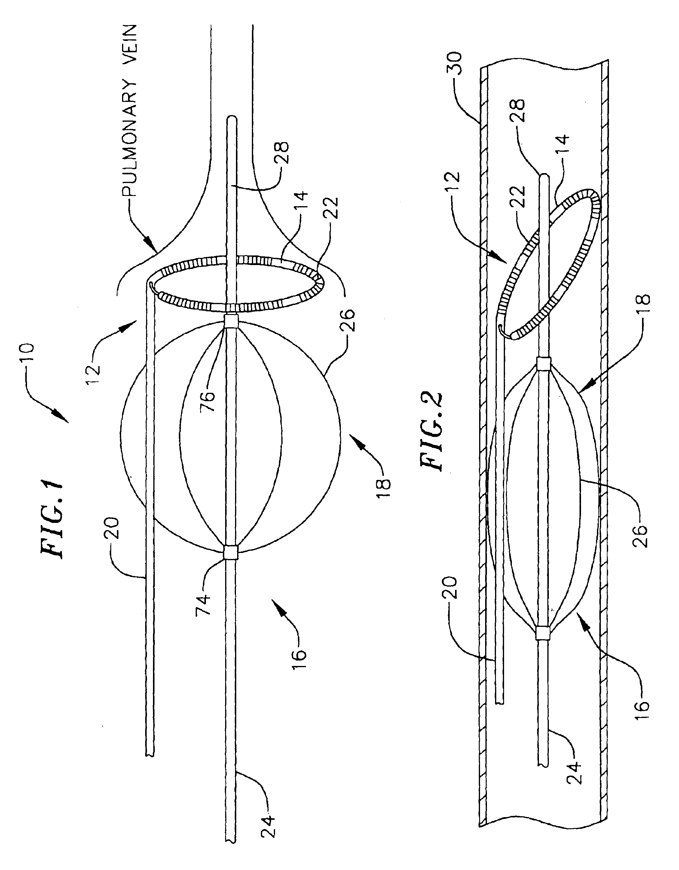 Loop structures for supporting diagnostic and therapeutic elements in contact with body tissue and expandable push devices for use with same