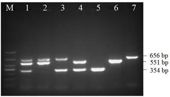 Method for detecting live salmonella typhimurium, salmonella paratyphi b and salmonella typhi in food simultaneously and rapidly