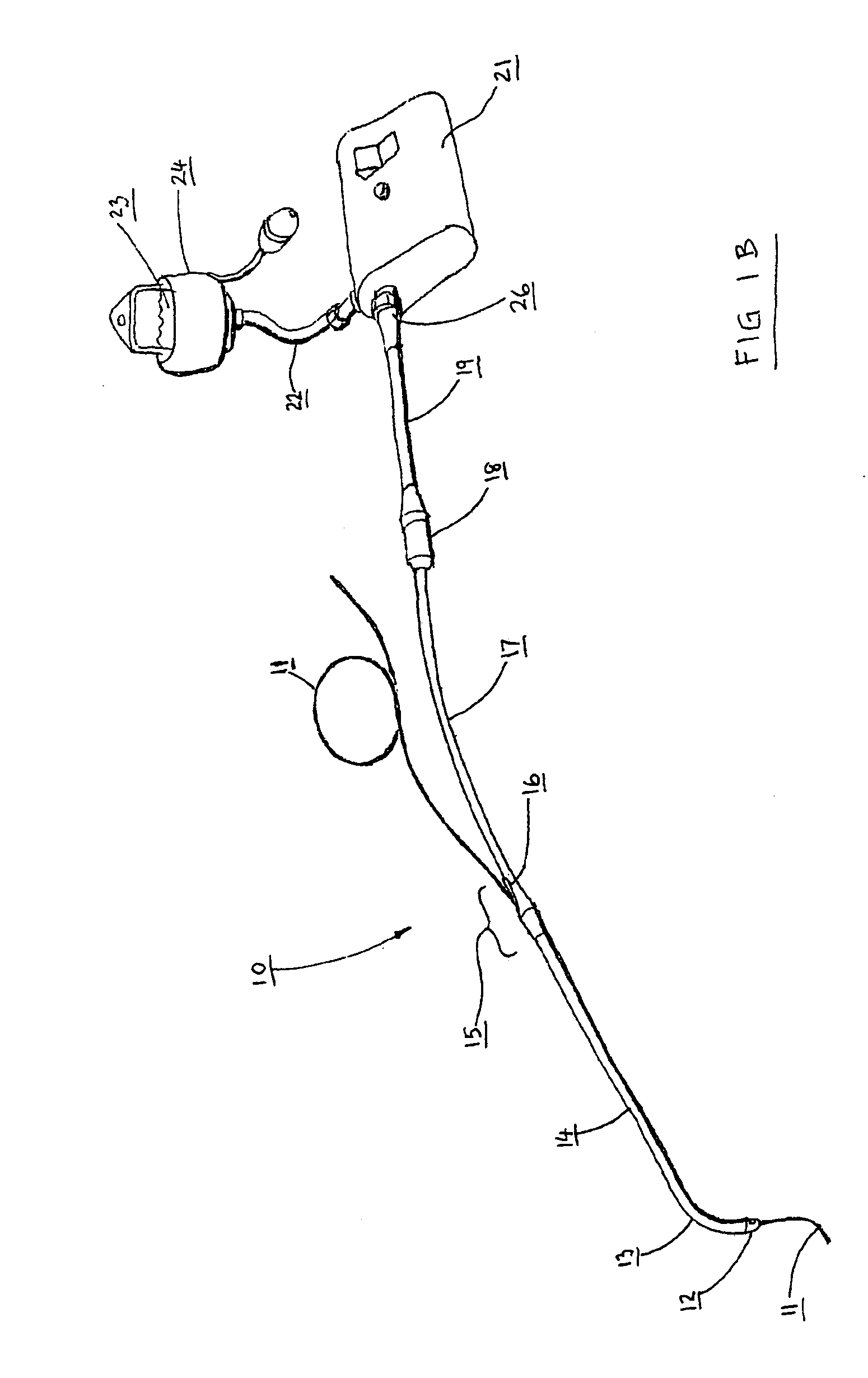 Catheter for conducting a procedure within a lumen, duct or organ of a living being