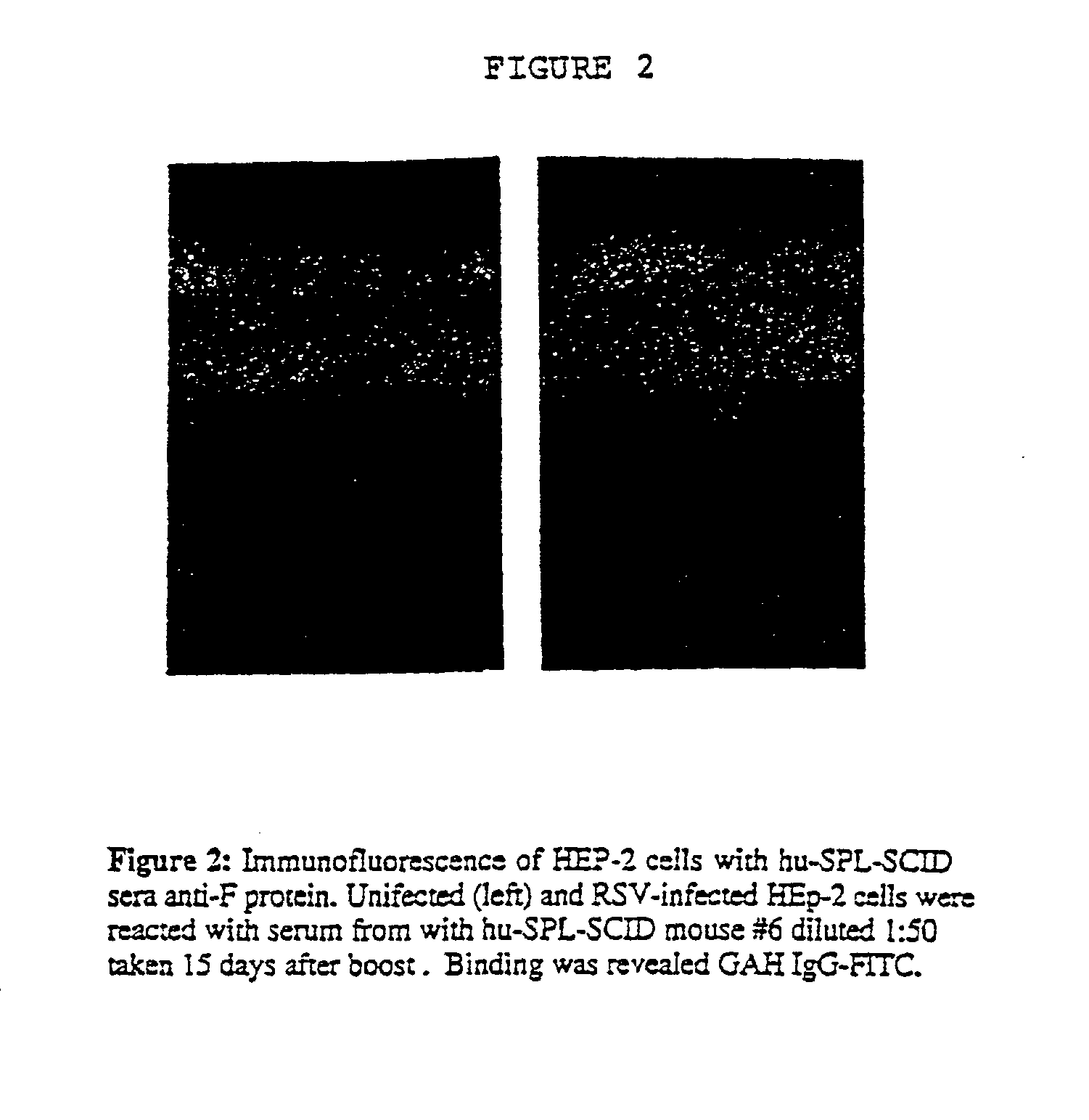 Neutralizing high affinity human monoclonal antibodies specific to RSV F-protein and methods for their manufacture and therapeutic use thereof