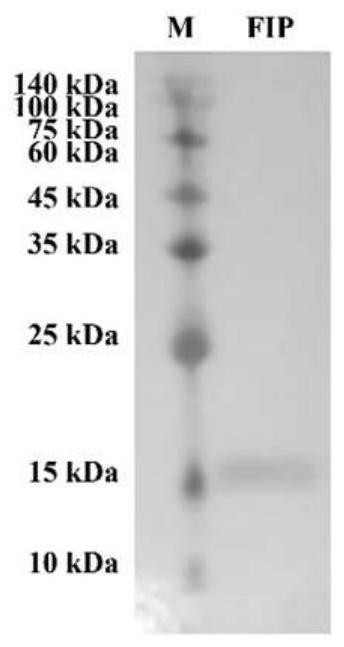 Fungal immunomodulatory protein derived from Morchella conica and application thereof