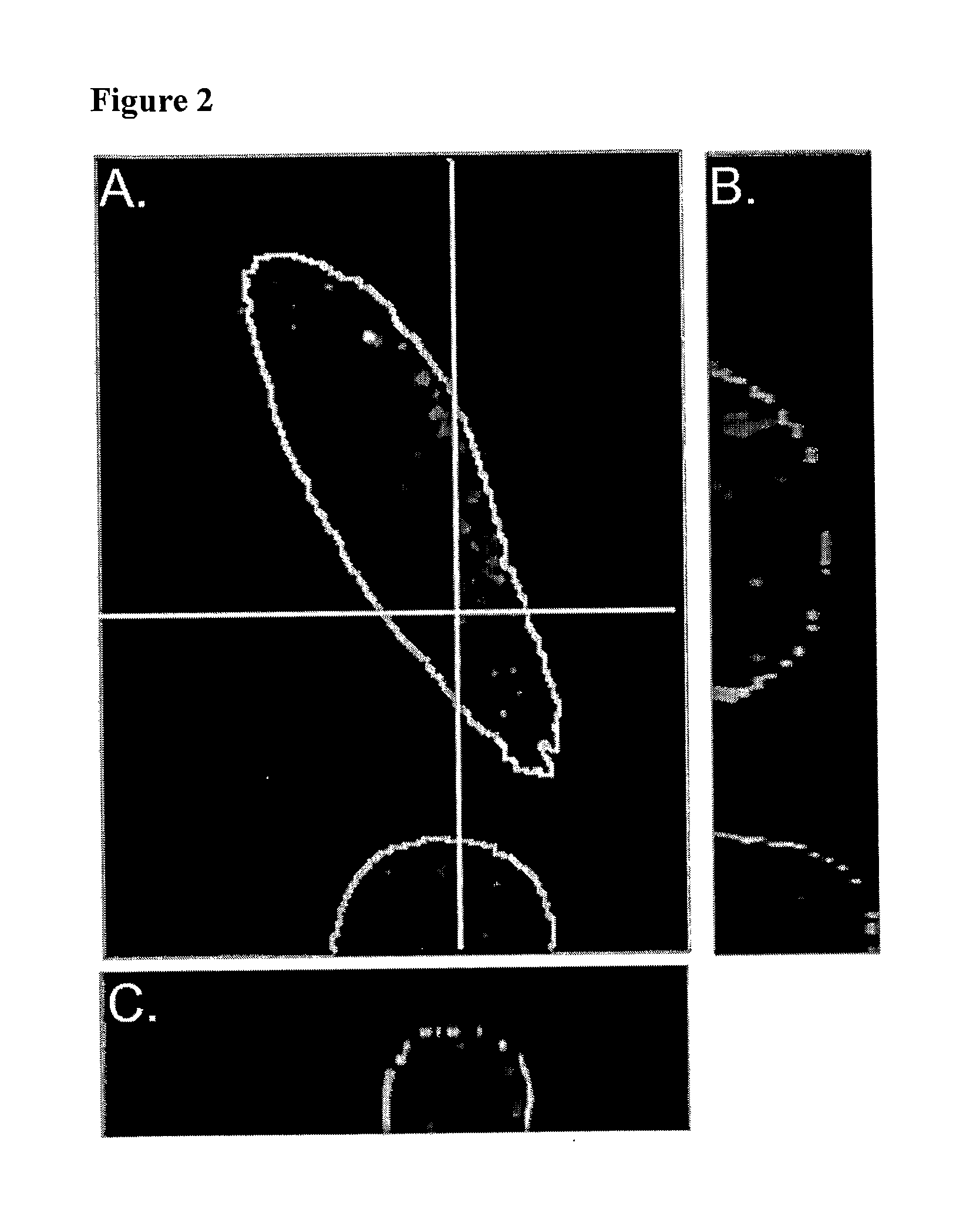 Antibody conjugates for circumventing multi-drug resistance