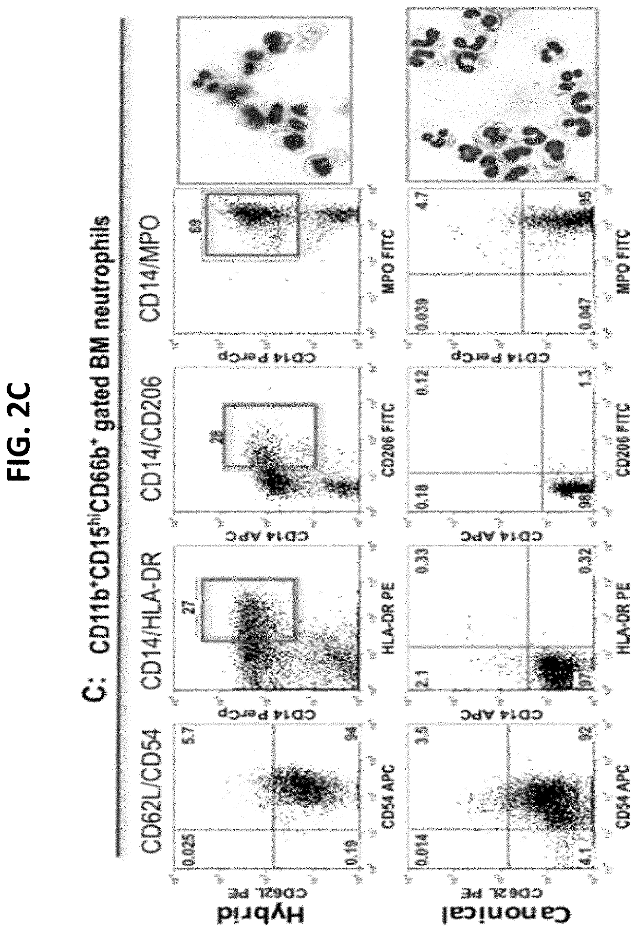 Compositions and methods of enhancing Anti-tumor response using hybrid neutrophils