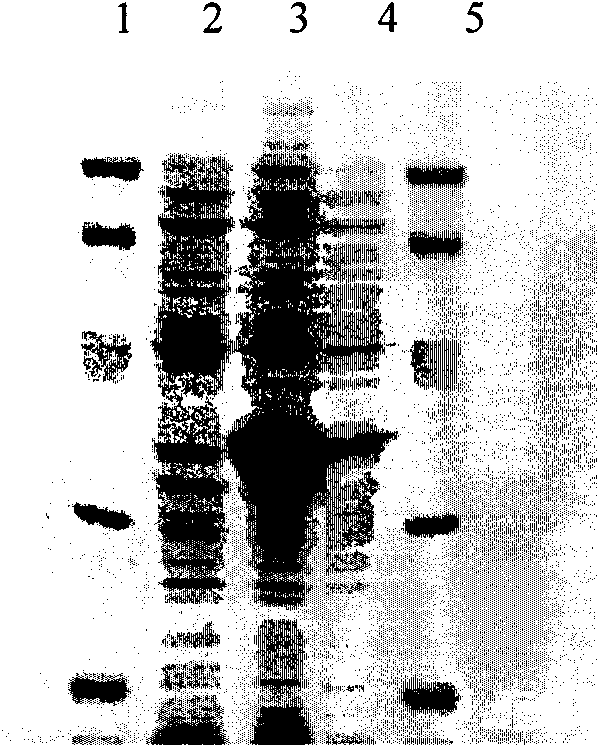 Preparation method and application of recombinant protein A gene and expression product thereof