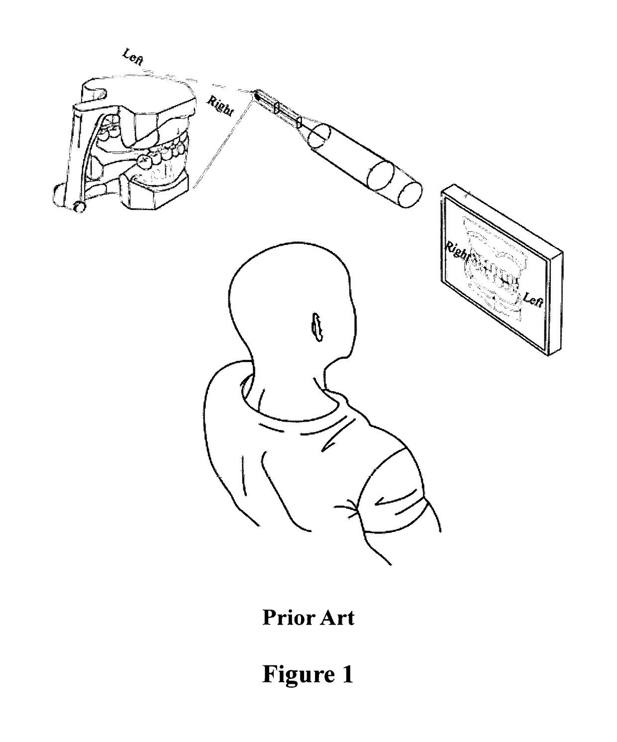 Oral endoscope detection system and detection method thereof