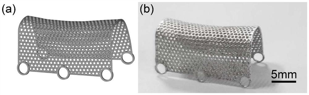 Degradable magnesium mesh for 3D printing personalized alveolar bone defect reconstruction