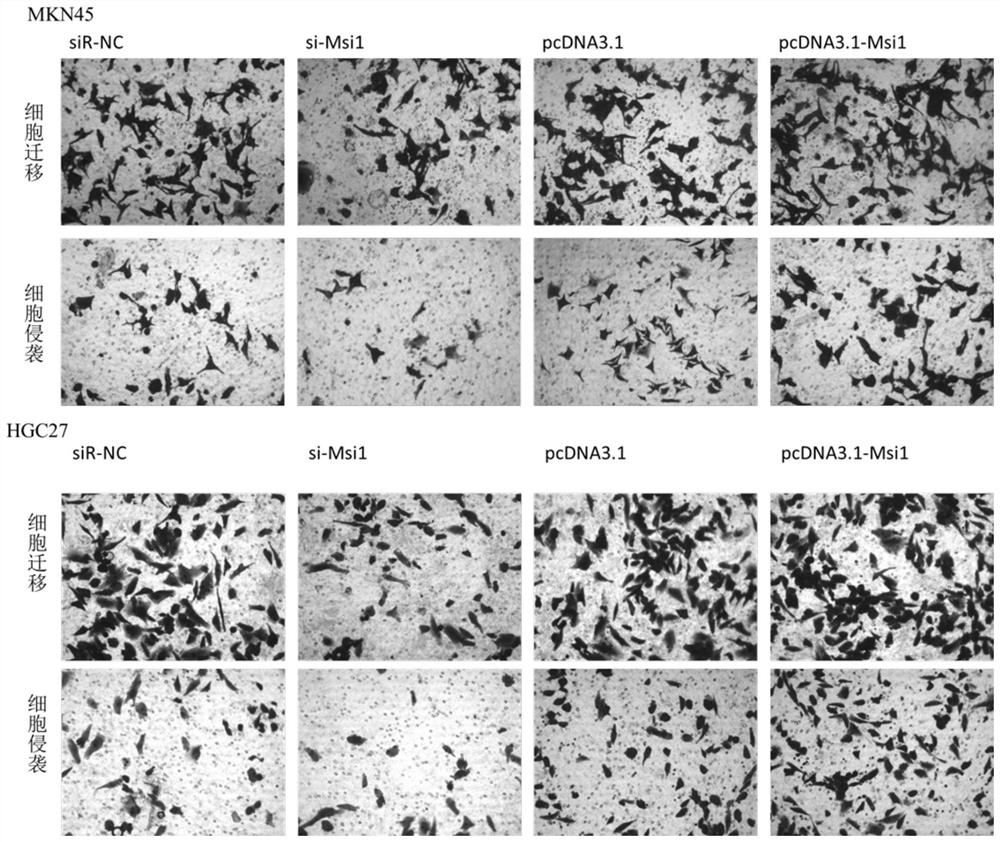 Application of Msi1 in preparation of gastric cancer treating preparation and prediction of tolerance of chemotherapy drug