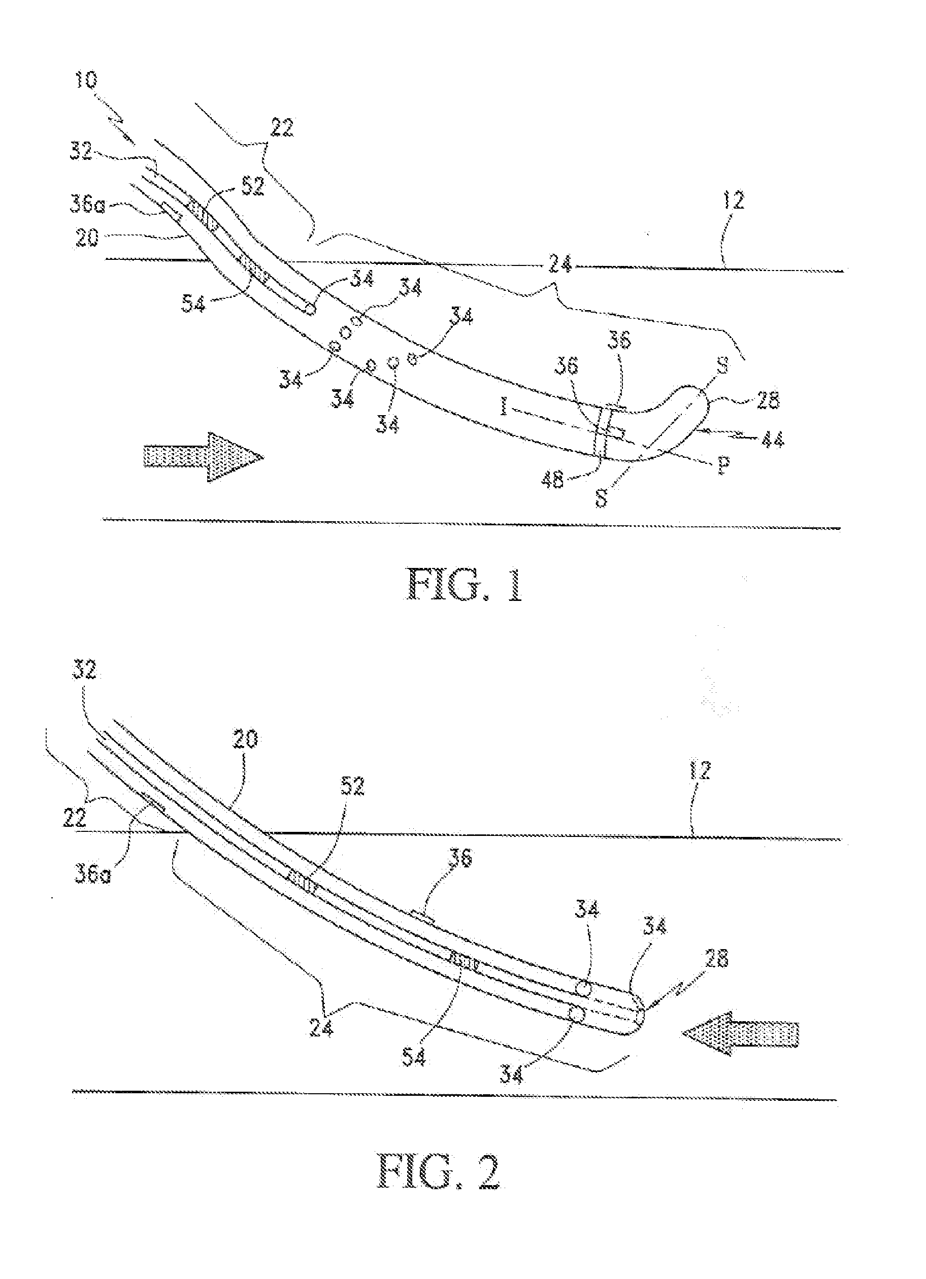 Catheter with common guide wire and indicator lumen