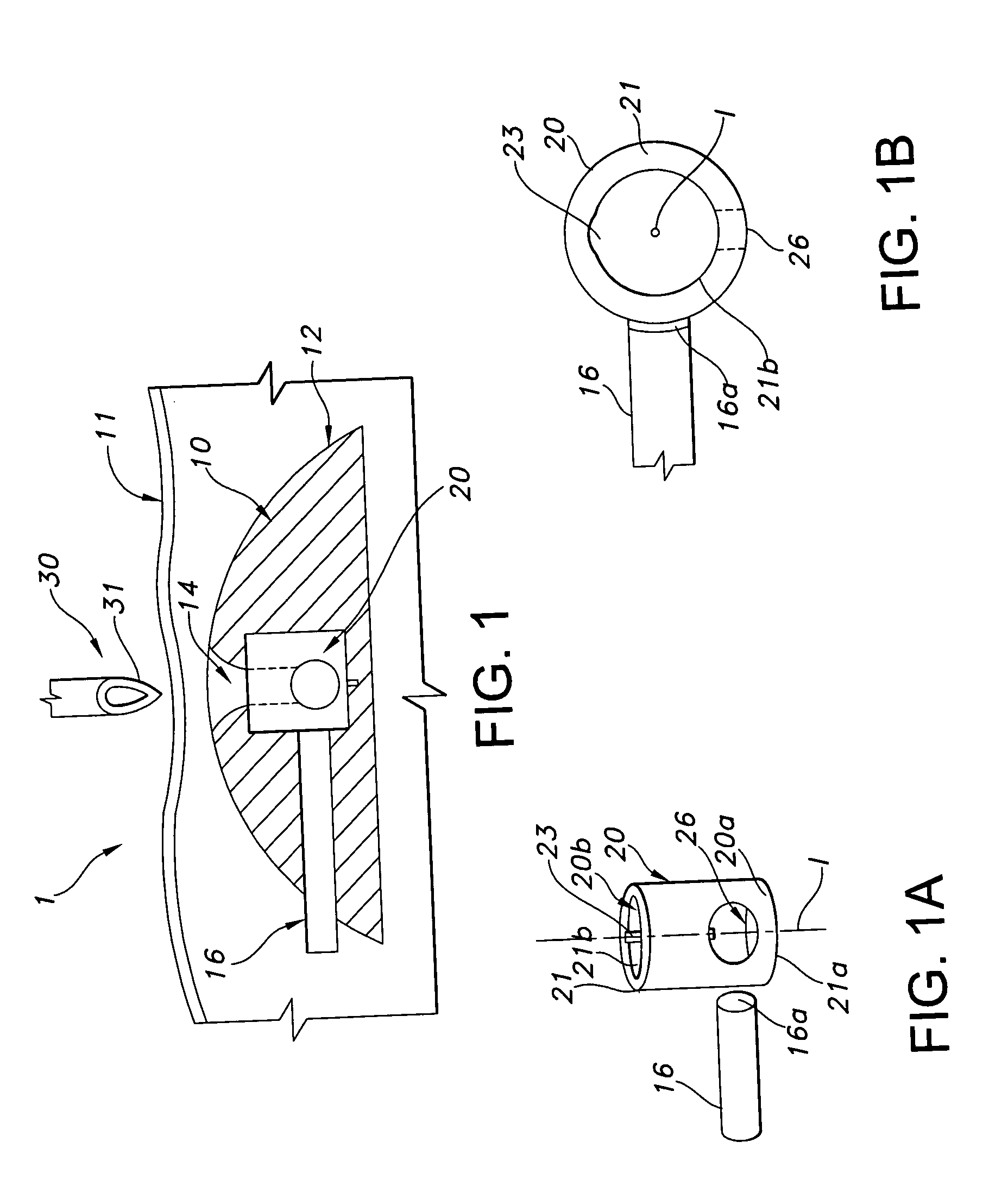 Valve port assembly with coincident engagement member for fluid transfer procedures