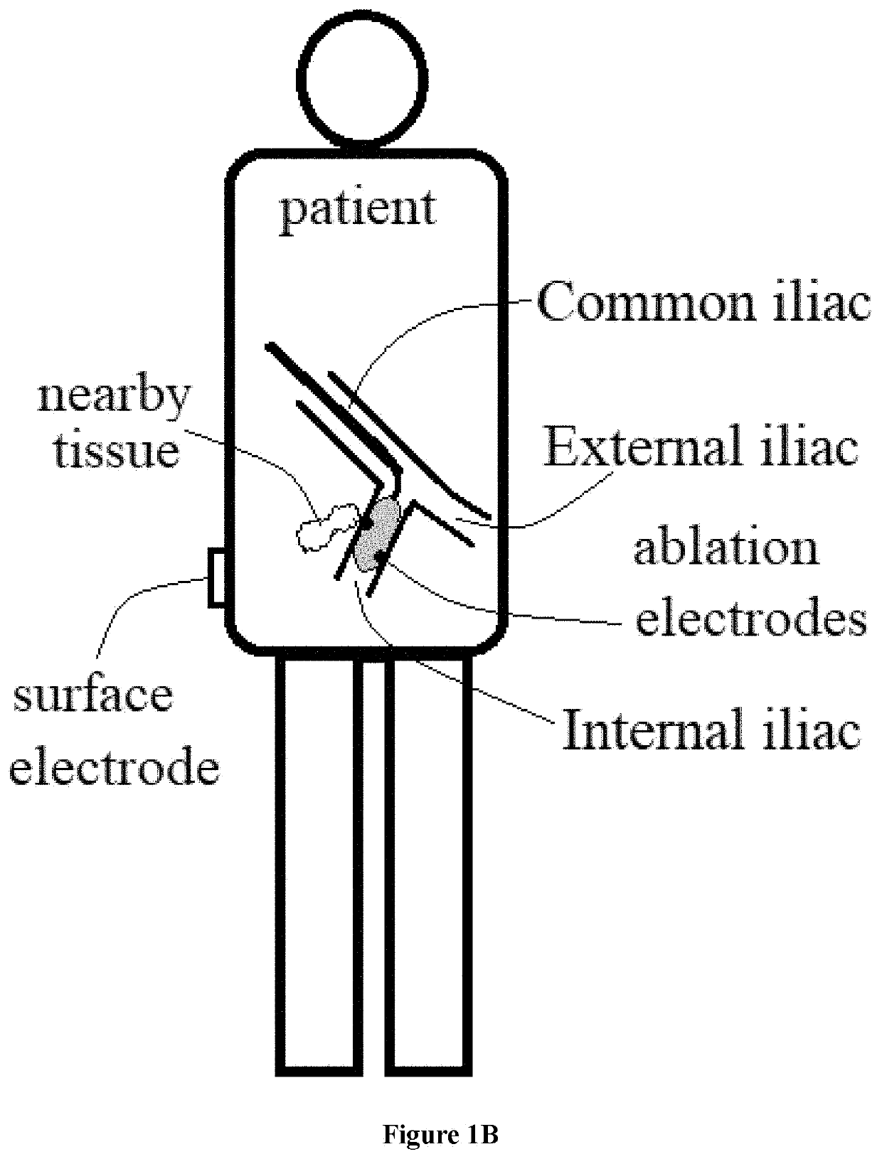 Method of treating or alleviating erectile dysfunction