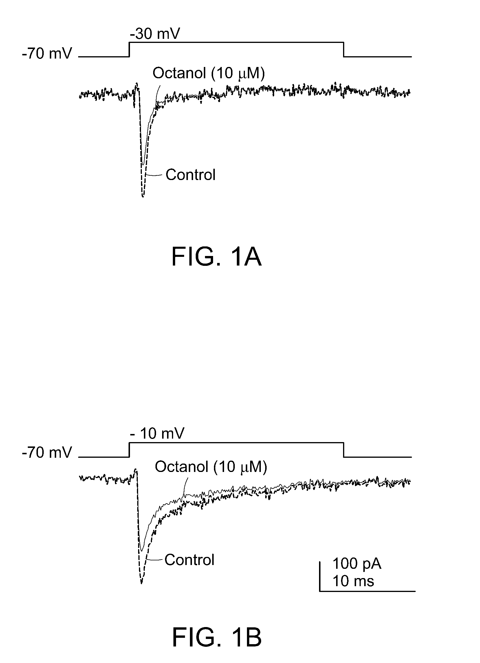 Methods and Compositions for Treating Thalamocortical Dysrhythmia