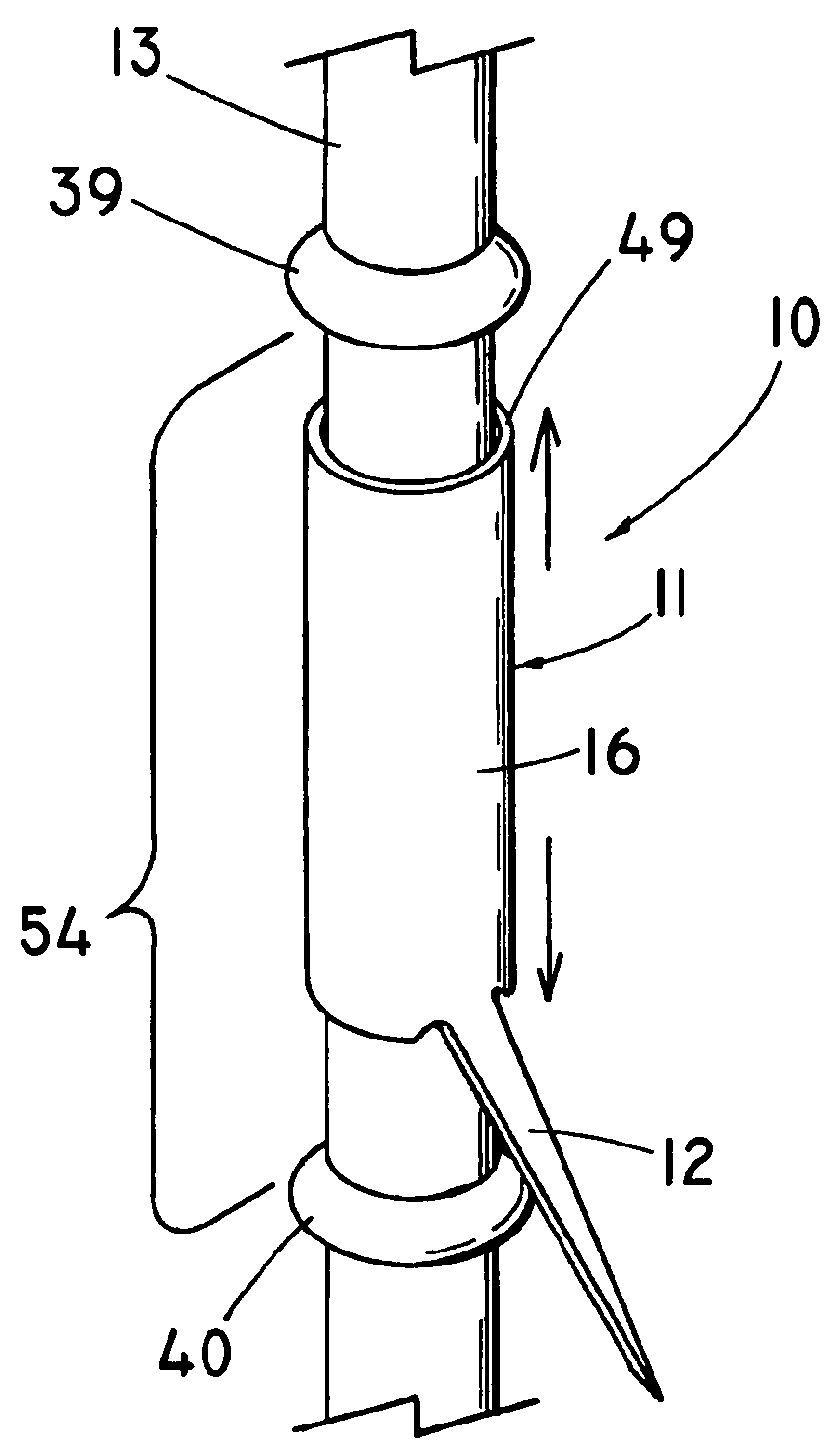 Anchoring barb for attachment to a medical prosthesis