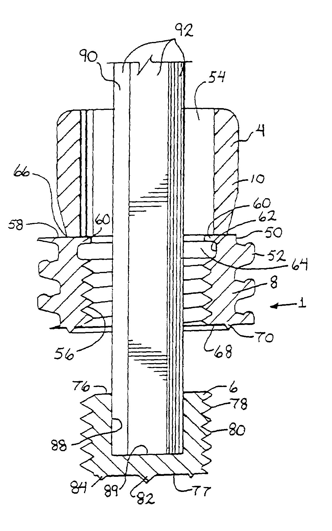 Medical implant fastener with nested set screw and method