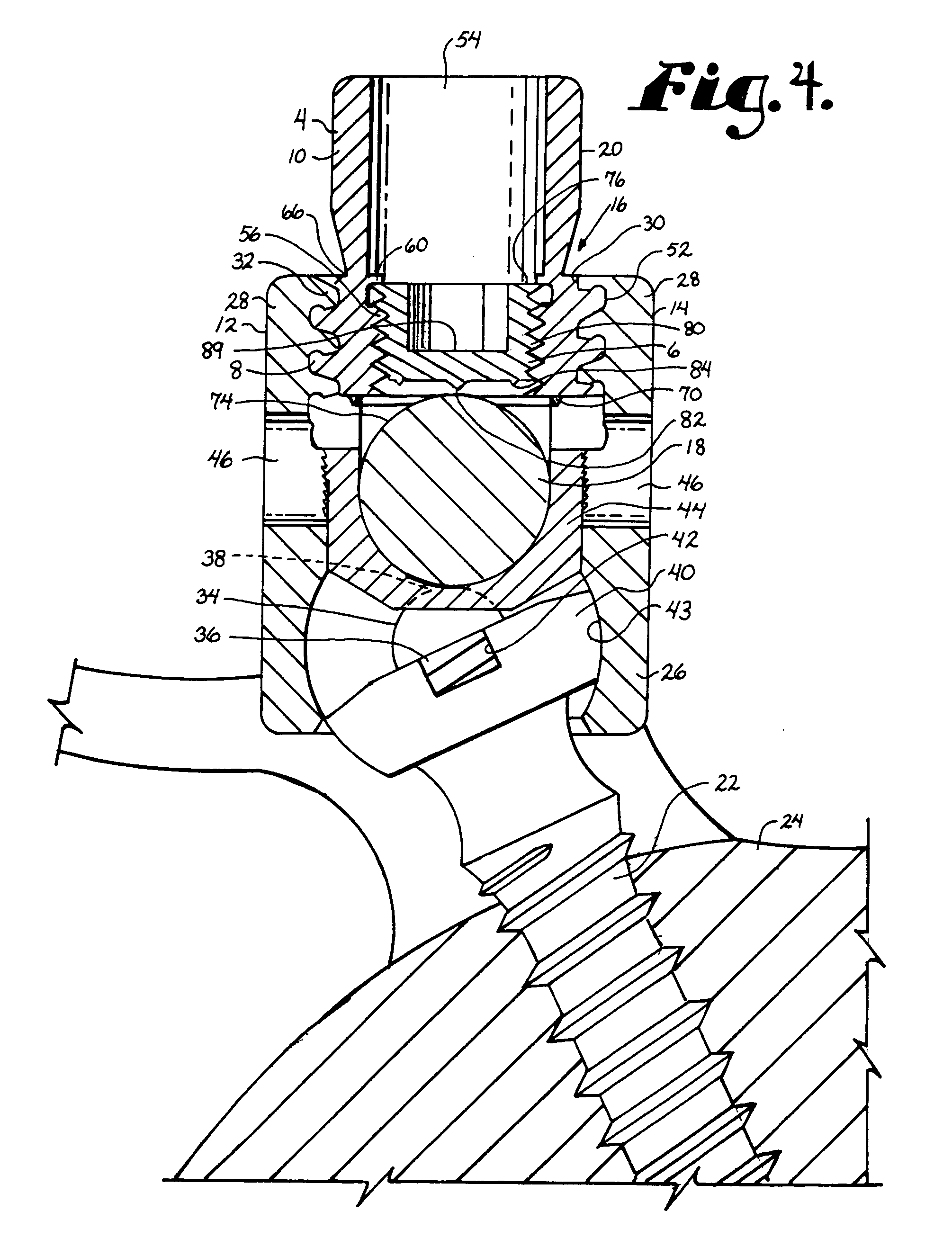 Medical implant fastener with nested set screw and method