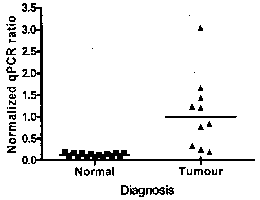 Trim59 directed diagnostics for neoplastic disease