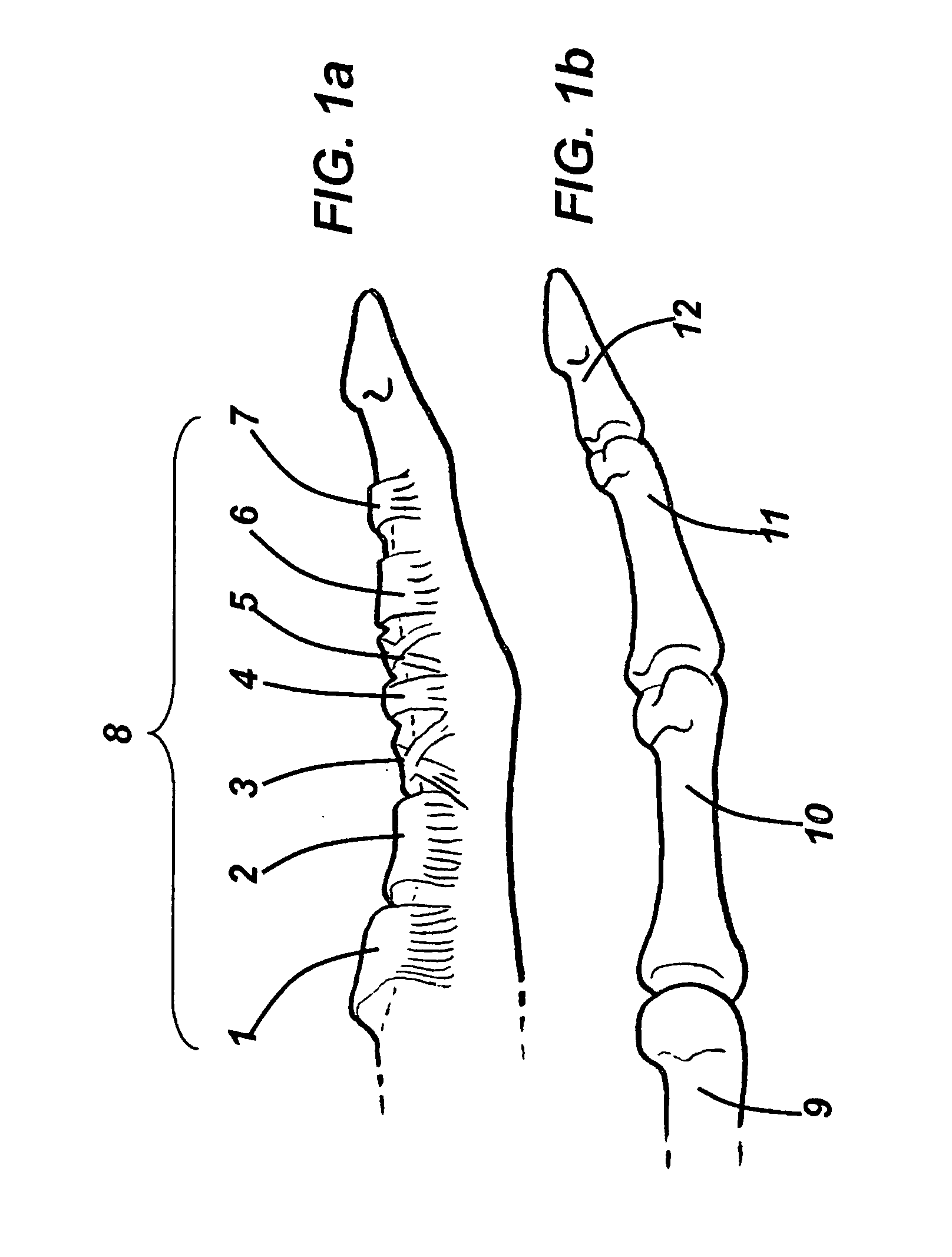 Device for assisting in flexor tendon repair and rehabilitation