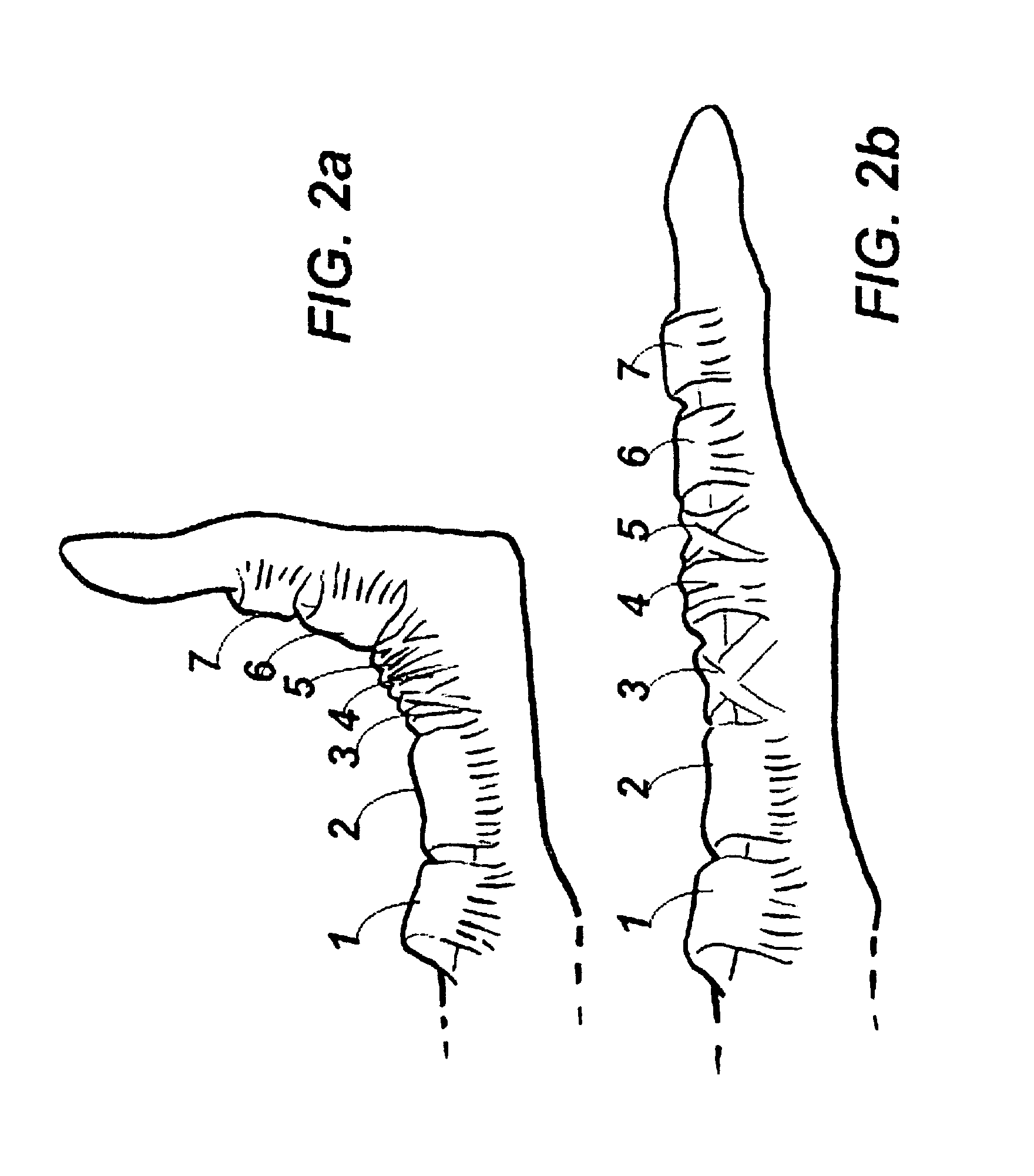 Device for assisting in flexor tendon repair and rehabilitation