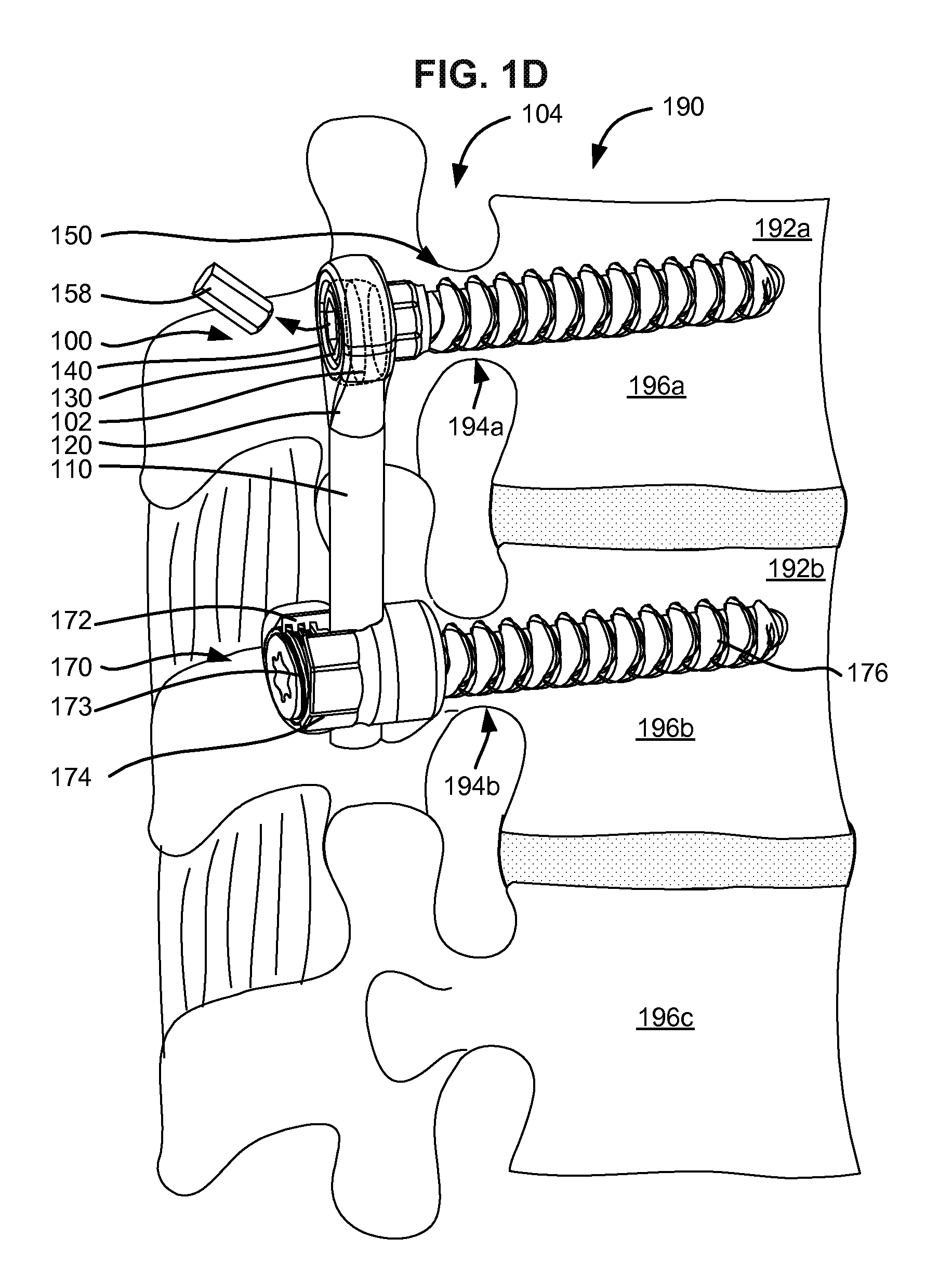 Adaptive spinal rod and methods for stabilization of the spine