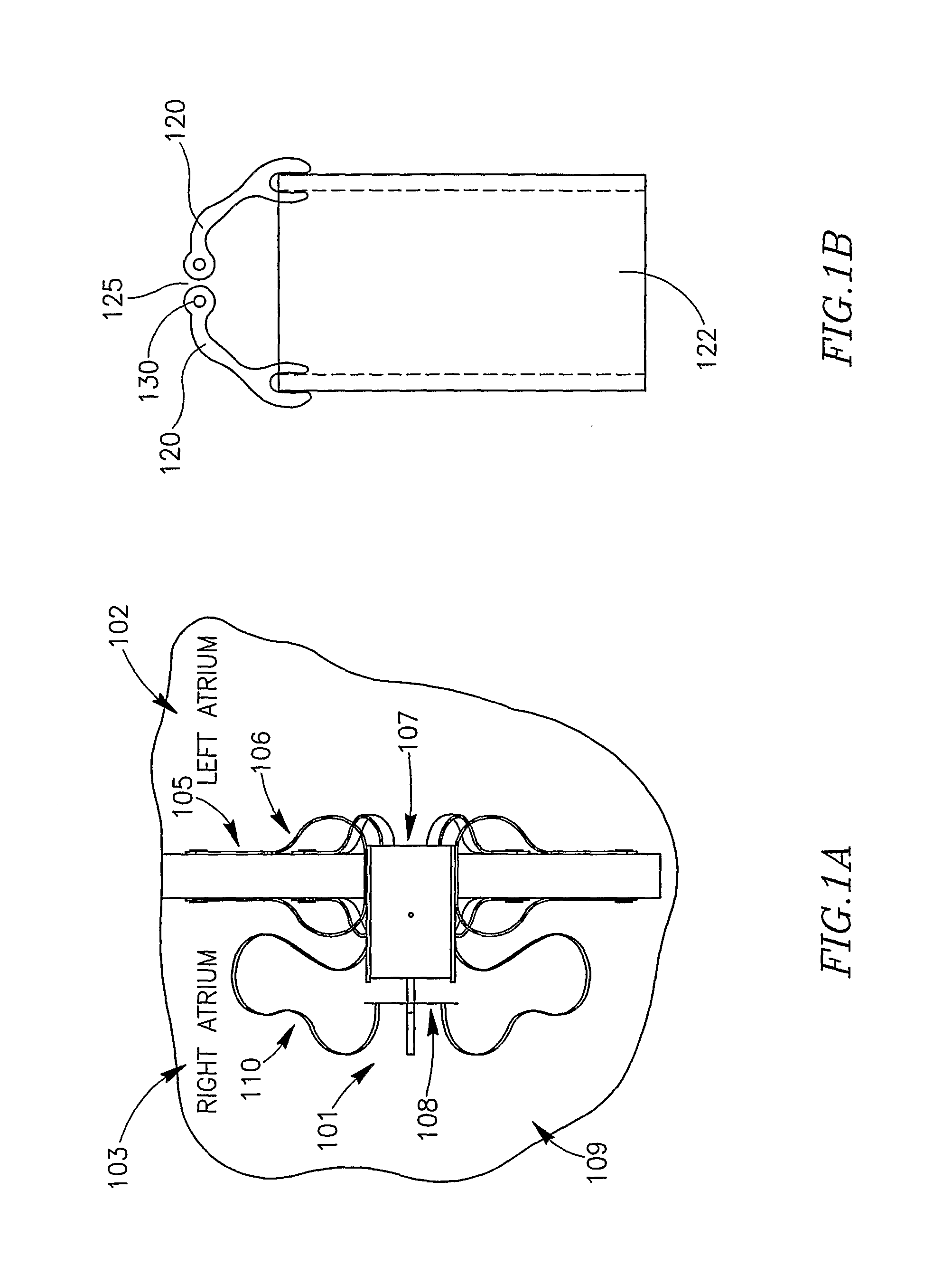 Device And Method For Controlling In-Vivo Pressure