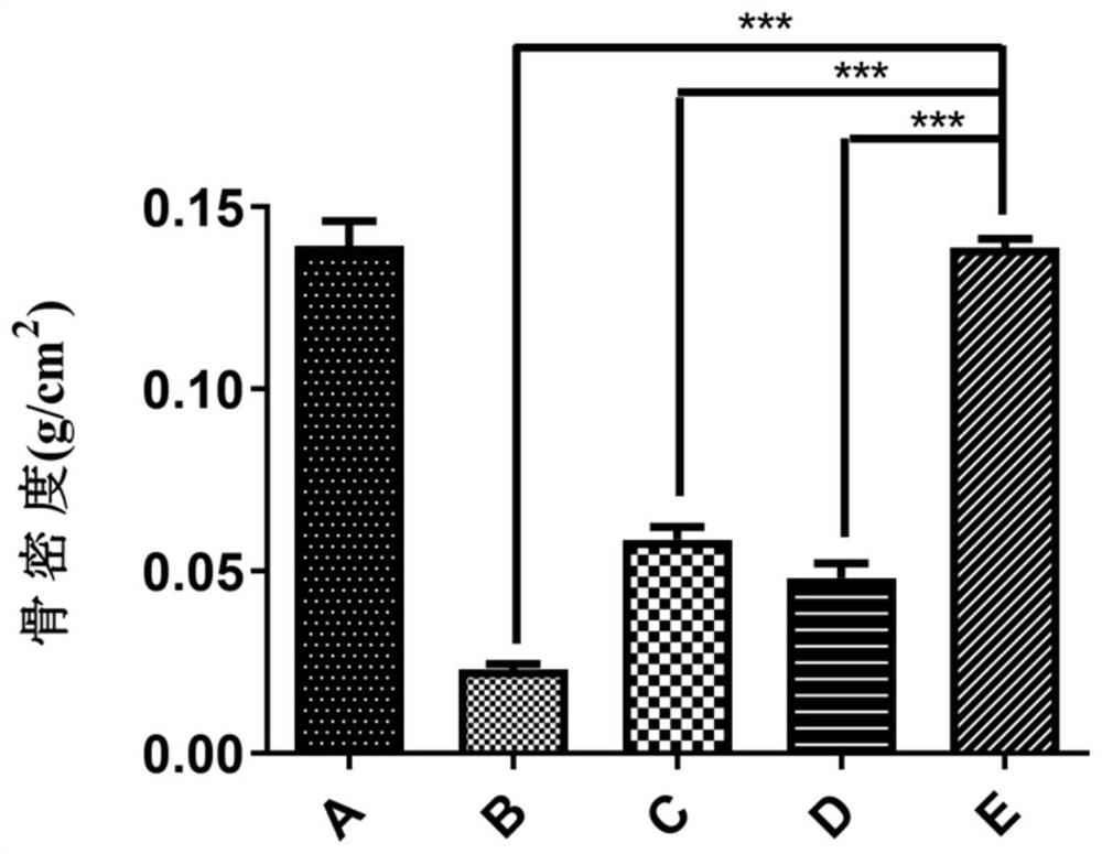 A kind of simvastatin-loaded bone targeting composite lipid nanoparticle and its application